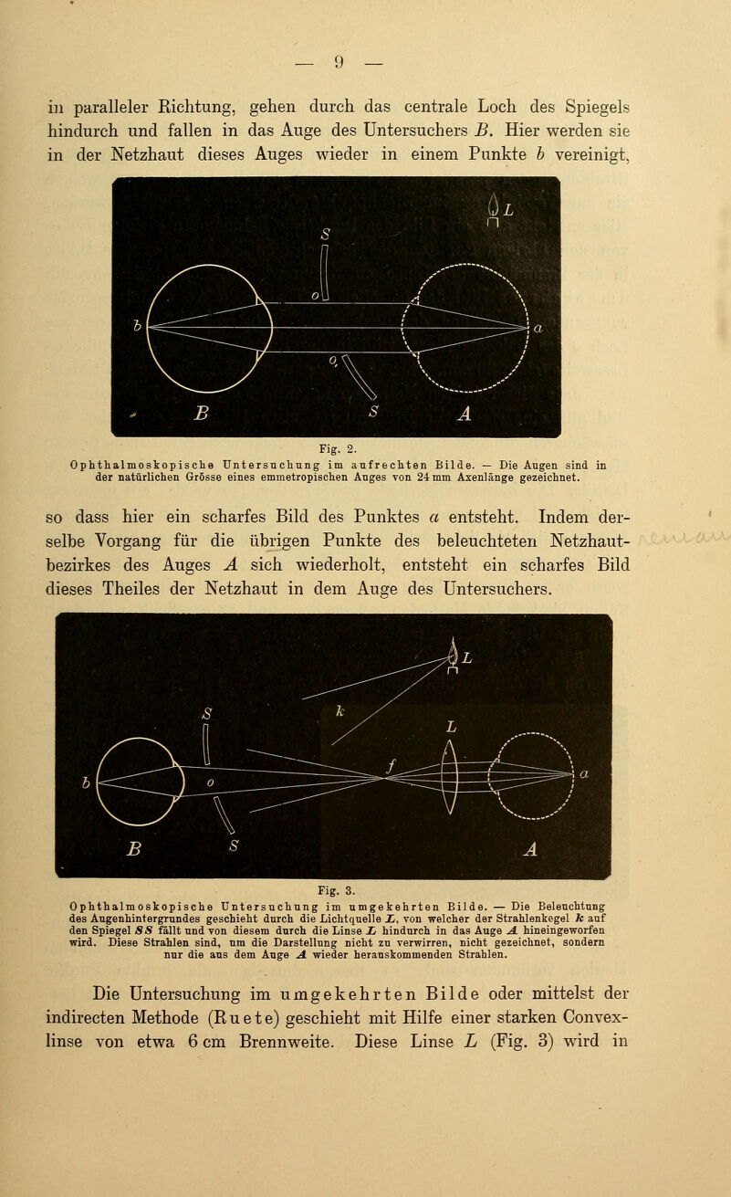 in paralleler Richtung, gehen durch das centrale Loch des Spiegels hindurch und fallen in das Auge des Untersuchers B. Hier werden sie in der Netzhaut dieses Auges wieder in einem Punkte b vereinigt, Fig. 2. Ophthalmoskopische Untersuchung im aufrechten Bilde. — Die Augen sind in der natürlichen Grösse eines enrmetropischen Auges von 24 mm Axenlänge gezeichnet. so dass hier ein scharfes Bild des Punktes a entsteht. Indem der- selbe Vorgang für die übrigen Punkte des beleuchteten Netzhaut- bezirkes des Auges A sich wiederholt, entsteht ein scharfes Bild dieses Theiles der Netzhaut in dem Auge des Untersuchers. Fig. 3. Ophthalmoskopische Untersuchung im umgekehrten Bilde. — Die Beleuchtung des Augenhintergrundes geschieht durch die Lichtquelle X, von welcher der Strahlenkegel Je auf den Spiegel SS fällt und von diesem dnrch die Linse i hindurch in das Auge A. hineingeworfen wird. Diese Strahlen sind, um die Darstellung nicht zu verwirren, nicht gezeichnet, sondern nur die aus dem Auge A. wieder herauskommenden Strahlen. Die Untersuchung im umgekehrten Bilde oder mittelst der indirecten Methode (R u e t e) geschieht mit Hilfe einer starken Convex- linse von etwa 6 cm Brennweite. Diese Linse L (Fig. 3) wird in