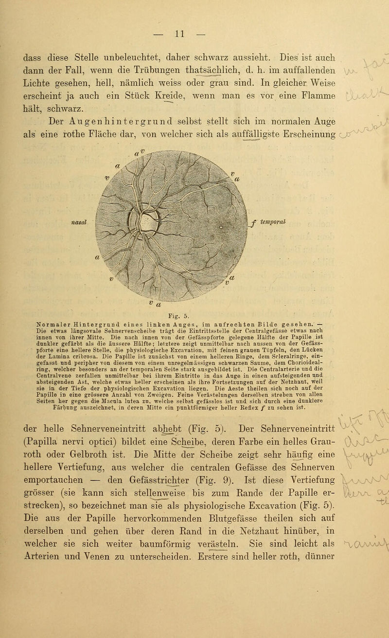 dass diese Stelle unbeleuchtet, daher schwarz aussieht. Dies ist auch dann der Fall, wenn die Trübungen thatsächlich, d. h. im auffallenden Lichte gesehen, hell, nämlich weiss oder grau sind. In gleicher Weise erscheint ja auch ein Stück Kreide, wenn man es vor eine Flamme hält, schwarz. Der Augenhintergrund selbst stellt sich im normalen Auge als eine rothe Fläche dar, von welcher sich als auffälligste Erscheinung ~_y: a\7: nasal [_^s2X^l'M{F^^-  If temporal Fig. 5. Normaler Hintergrund eines linken Auges, im aufrechten Bilde gesehen. — Die etwas längsovale Sehnervenscheibe trägt die Eintrittsstelle der Centralgefässe etwas nach innen von ihrer Mitte. Die nach innen von der Gefässpforte gelegene Hälfte der Papille ist dunkler gefärbt als die äussere Hälfte; letztere zeigt unmittelbar nach aussen von der Gefäss- pforte eine hellere Stelle, die physiologische Excavation, mit feinen grauen Tüpfeln, den Lücken der Lamina cribrosa. Die Papille ist zunächst von einem helleren Ringe, dem Scleralringe, ein- gefasst und peripher von diesem von einem unregelmässigen schwarzen Saume, dem Chorioideal- ring, welcher besonders an der temporalen Seite stark ausgebildet ist. Die Centralarterie und die Centralvene zerfallen unmittelbar bei ihrem Eintritte in das Auge in einen aufsteigenden und absteigenden Ast, welche etwas heller erscheinen als ihre Fortsetzungen auf der Netzhaut, weil sie in der Tiefe der physiologischen Excavation liegen. Die Aeste theilen sich noch auf der Papille in eine grössere Anzahl von Zweigen. Feine Verästelungen derselben streben von allen Seiten her gegen die Macula lutea zu, welche selbst gefässlos ist und sich durch eine dunklere Färbung auszeichnet, in deren Mitte ein punktförmiger heller Reflex / zu sehen ist. der helle Sehnerveneintritt abhebt (Fig. 5). Der Sehnerveneintritt (Papilla nervi optici) bildet eine Scheibe, deren Farbe ein helles Grau- 0v>-^ roth oder Gelbroth ist. Die Mitte der Scheibe zeigt sehr häufig eine \ hellere Vertiefung, aus welcher die centralen Gefässe des Sehnerven emportauchen — den Gefässtrichter (Fig. 9). Ist diese Vertiefung grösser (sie kann sich stellenweise bis zum Bande der Papille er- strecken), so bezeichnet man sie als physiologische Excavation (Fig. 5). Die aus der Papille hervorkommenden Blutgefässe theilen sich auf derselben und gehen über deren Band in die Netzhaut hinüber, in welcher sie sich weiter baumförmig verästeln. Sie sind leicht als Arterien und Venen zu unterscheiden. Erstere sind heller roth, dünner