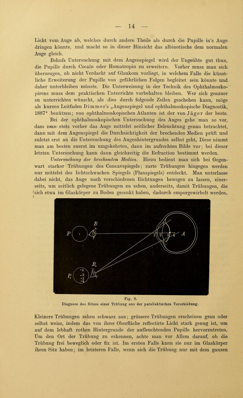 Licht vom Auge ab, welches durch andere Theile als durch die Pupille in's Auge dringen könnte, und macht so in dieser Hinsicht das albinotische dem normalen Auge gleich. Behufs Untersuchung mit dem Augenspiegel wird der Ungeübte gut thun, die Pupille durch Cocain oder Homatropin zu erweitern. Vorher muss man sich überzeugen, ob nicht Verdacht auf Glaukom vorliegt, in welchem Falle die künst- liche Erweiterung der Pupille von gefährlichen Folgen begleitet sein könnte und daher unterbleiben müsste. Die Unterweisung in der Technik des Ophthalmosko- pirens muss dem praktischen Unterrichte vorbehalten bleiben. Wer sich genauer zu unterrichten wünscht, als dies durch folgende Zeilen geschehen kann, möge als kurzen Leitfaden Dimmer's „Augenspiegel und ophthalmoskopische Diagnostik, 1887 benützen; von ophthalmoskopischen Atlanten ist der von Jäger der beste. Bei der ophthalmoskopischen Untersuchung des Auges gehe man so vor, dass man- stets vorher das Auge mittelst seitlicher Beleuchtung genau betrachtet, dann mit dem Augenspiegel die Durchsichtigkeit der brechenden Medien prüft und zuletzt erst an die Untersuchung des Augenhintergrundes selbst geht. Diese nimmt man am besten zuerst im umgekehrten, dann im aufrechten Bilde vor; bei dieser letzten Untersuchung kann dann gleichzeitig die Refraction bestimmt werden. Untersuchung der brechenden Medien. Hiezu bedient man sich bei Gegen- wart starker Trübungen des Concavspiegels; zarte Trübungen hingegen werden nur mittelst des lichtschwachen Spiegels (Planspiegels) entdeckt. Man unterlasse dabei nicht, das Auge nach verschiedenen Richtungen bewegen zu lassen, einer- seits, um seitlich gelegene Trübungen zu sehen, anderseits, damit Trübungen, die > sich etwa im Glaskörper zu Boden gesenkt haben, dadurch emporgewirbelt werden. Fig. 8. Diagnose des Sitzes einer Trübung aus der parallaktischen Verschiebung. Kleinere Trübungen sehen schwarz aus; grössere Trübungen erscheinen grau oder selbst weiss, indem das von ihrer Oberfläche reflectirte Licht stark genug ist, um auf dem lebhaft rothen Hintergrunde der aufleuchtenden Pupille hervorzutreten. Um den Ort der Trübung zu erkennen, achte man vor Allem darauf, ob die Trübung frei beweglich oder fix ist. Im ersten Falle kann sie nur im Glaskörper ihren Sitz haben; im letzteren Falle, wenn sich die Trübung nur mit dem ganzen