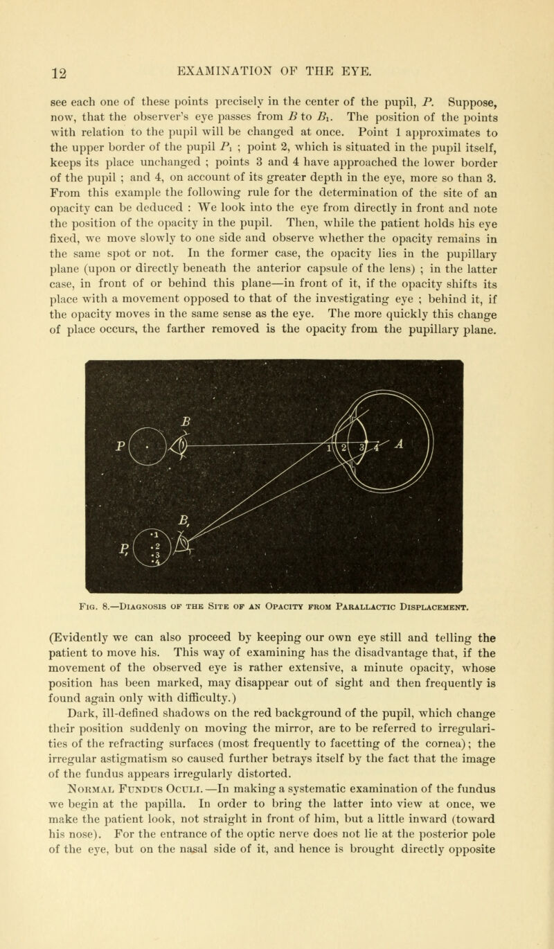 see each one of these points precisely in the center of the pupil, P. Suppose, now, that the observer's eye passes from B to Bi. The position of the points with relation to the pupil will be changed at once. Point 1 approximates to the upper border of the pupil Pi ; point 2, which is situated in the pupil itself, keeps its place unchanged ; points 3 and 4 have approached the lower border of the pupil ; and 4, on account of its greater depth in the eye, more so than 3. From this example the following rule for the determination of the site of an opacity can be deduced : We look into the eye from directly in front and note the position of the opacity in the pupil. Then, while the patient holds his eye fixed, we move slowly to one side and observe whether the opacity remains in the same spot or not. In the former case, the opacity lies in the pupillary plane (upon or directly beneath the anterior capsule of the lens) ; in the latter case, in front of or behind this plane—in front of it, if the opacity shifts its place with a movement opposed to that of the investigating eye ; behind it, if the opacity moves in the same sense as the eye. The more quickly this change of place occurs, the farther removed is the opacity from the pupillary plane. Fig. 8.—Diagnosis of the Site of an Opacity from Parallactic Displacement. (Evidently we can also proceed by keeping our own eye still and telling the patient to move his. This way of examining has the disadvantage that, if the movement of the observed eye is rather extensive, a minute opacity, whose position has been marked, may disappear out of sight and then frequently is found again only with difficulty.) Dark, ill-defined shadows on the red background of the pupil, which change their position suddenly on moving the mirror, are to be referred to irregulari- ties of the refracting surfaces (most frequently to facetting of the cornea); the irregular astigmatism so caused further betrays itself by the fact that the image of the fundus appears irregularly distorted. Normal Fundus Oculi.—In making a systematic examination of the fundus we begin at the papilla. In order to bring the latter into view at once, we make the patient look, not straight in front of him, but a little inward (toward his nose). For the entrance of the optic nerve does not lie at the posterior pole of the eye, but on the nasal side of it, and hence is brought directly opposite