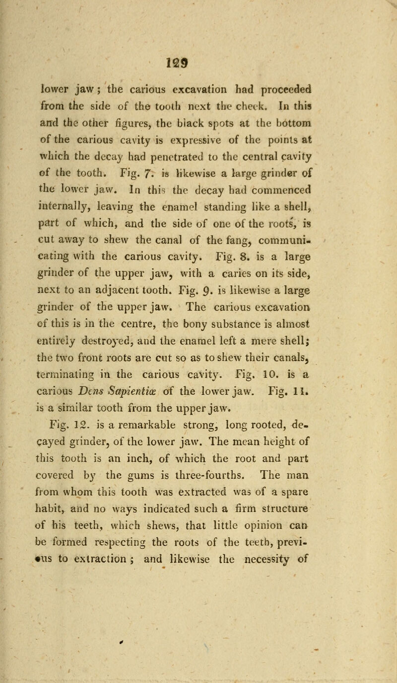 lower jaw ; the carious excavation had proceeded from the side of the tooth next the check. In this and the other figures, the biack spots at the bottom of the carious cavity is expressive of the points at which the decay had penetrated to the central cavity of the tooth. Fig. 7- is likewise a large grinder of the lower jaw. In this the decay had commenced internally, leaving the enamel standing like a shell, part of which, and the side of one of the roots', is cut away to shew the canal of the fang, communi- cating with the carious cavity. Fig. 8. is a large grinder of the upper jaw, with a caries on its side, next to an adjacent tooth. Fig. 9. is likewise a large grinder of the upper jaw. The carious excavation of this is in the centre, the bony substance is almost entirely destroyed, and the enamel left a mere shell; the two front roots are cut so as to shew their canals, terminating in the carious cavit}r. Fig. 10. is a carious Dens Sapieniix of the lower jaw. Fig. 11. is a similar tooth from the upper jaw. Fig. 12. is a remarkable strong, long rooted, de- cayed grinder, of the lower jaw. The mean height of this tooth is an inch, of which the root and part covered by the gums is three-fourths. The man from whom this tooth was extracted was of a spare habit, and no ways indicated such a firm structure of his teeth, which shews, that little opinion can be formed respecting the roots of the teeth, previ- ous to extraction; and likewise the necessity of