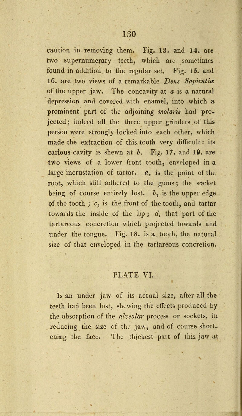 caution in removing them. Fig. 13. and 14. are two supernumerary teeth, which are sometimes found in addition to the regular set. Fig. 15. and 16. are two views of a remarkable Dens Sapientia of the upper jaw. The concavity at a is a natural depression and covered with enamel, into which a prominent part of the adjoining molaris had pro- jected; indeed all the three upper grinders of this person were strongly locked into each other, which made the extraction of this tooth very difficult: its carious cavity is shewn at b. Fig. 17. and lfi. are t\vo views of a lower front tooth, enveloped in a large incrustation of tartar, a, is the point of the root, which still adhered to the gums; the socket being of course entirely lost. &, is the upper edge of the tooth ; c, is the front of the tooth, and tartar towards the inside of the lip; d, that part of the tartareous concretion which projected towards and under the tongue. Fig. 18. is a tooth, the natural size of that enveloped in the tartareous concretion. PLATE VI. i Is an under jaw of its actual size, after all the teeth had been lost, shewing the effects produced by the absorption of the alveolar process or sockets, in reducing the size of the jaw, and of course short- ening the face. The thickest part of this jaw at