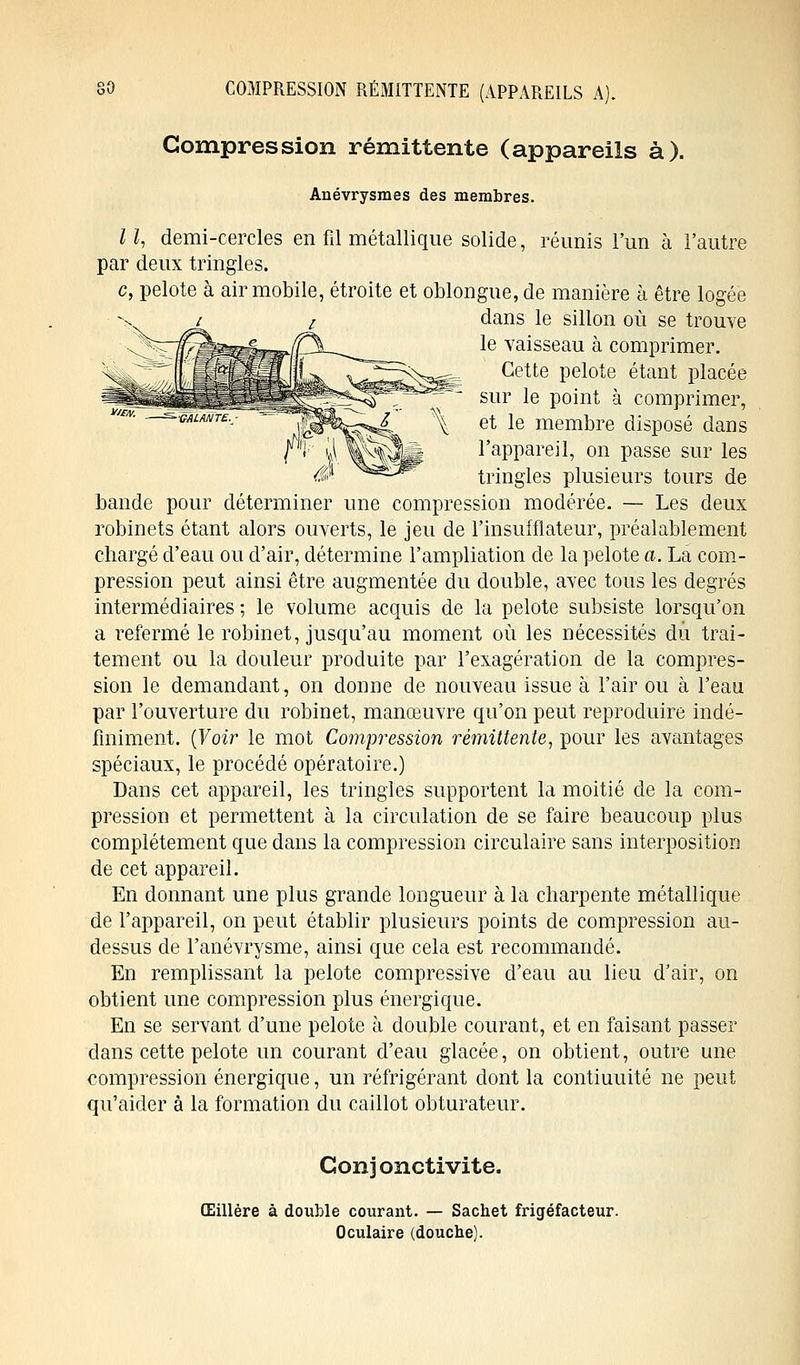 SO COMPRESSION RÉMITTENTE (APPAREILS A). Compression rémittente (appareils à). Anévrysmes des membres. I1, demi-cercles en fil métallique solide, réunis l'un à l'autre par deux tringles. c, pelote à air mobile, étroite et oblongue, de manière à être logée dans le sillon où se trouve le vaisseau à comprimer. Cette pelote étant placée sur le point à comprimer, et le membre disposé dans l'appareil, on passe sur les tringles plusieurs tours de bande pour déterminer une compression modérée. — Les deux robinets étant alors ouverts, le jeu de l'insuîflateur, préalablement chargé d'eau ou d'air, détermine l'ampliation de la pelote a. La com- pression peut ainsi être augmentée du double, avec tous les degrés intermédiaires ; le volume acquis de la pelote subsiste lorsqu'on a refermé le robinet, jusqu'au moment où les nécessités du trai- tement ou la douleur produite par l'exagération de la compres- sion le demandant, on donne de nouveau issue à l'air ou à l'eau par l'ouverture du robinet, manœuvre qu'on peut reproduire indé- finiment. (Voir le mot Compression rémittente, pour les avantages spéciaux, le procédé opératoire.) Dans cet appareil, les tringles supportent la moitié de la com- pression et permettent à la circulation de se faire beaucoup plus complètement que dans la compression circulaire sans interposition de cet appareil. En donnant une plus grande longueur à la charpente métallique de l'appareil, on peut établir plusieurs points de compression au- dessus de Fanévrysme, ainsi que cela est recommandé. En remplissant la pelote compressive d'eau au lieu d'air, on obtient une compression plus énergique. En se servant d'une pelote à double courant, et en faisant passer clans cette pelote un courant d'eau glacée, on obtient, outre une compression énergique, un réfrigérant dont la contiuuité ne peut qu'aider à la formation du caillot obturateur. Conjonctivite. Œillère à double courant. — Sachet frigéfacteur. Oculaire (douche).