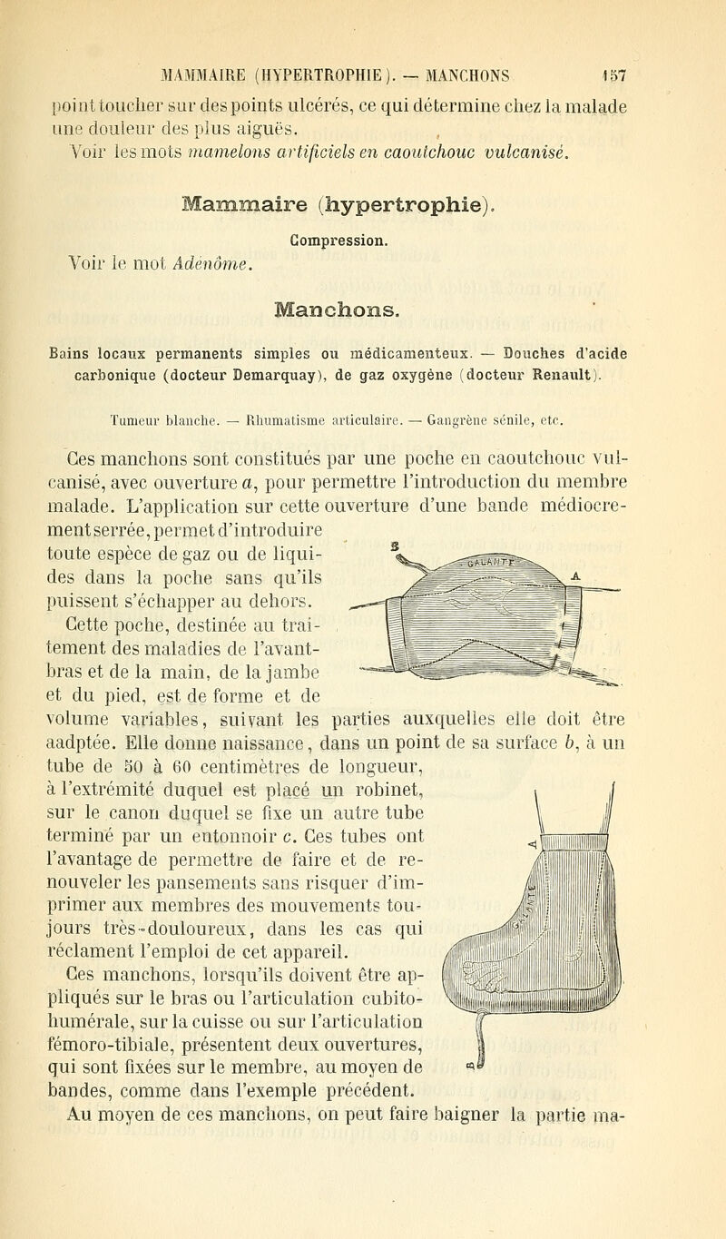 point toucher sur des points ulcérés, ce qui détermine chez la malade une douleur des plus aiguës. Voir les mots mamelons artificiels en caoutchouc vulcanisé. Mammaire (hypertrophie). Compression. Voir le mot Adénome. Bains locaux permanents simples ou médicamenteux. — Douches d'acide carbonique (docteur Demarquay), de gaz oxygène (docteur Renault). Tumeur blanche. — Rhumatisme articulaire. — Gangrène sénile, etc. Ces manchons sont constitués par une poche en caoutchouc vul- canisé, avec ouverture a, pour permettre l'introduction du membre malade. L'application sur cette ouverture d'une bande médiocre- ment serrée, permet d'introduire toute espèce de gaz ou de liqui- des dans la poche sans qu'ils puissent s'échapper au dehors. Cette poche, destinée au trai- tement des maladies de l'avant- bras et de la main, de la jambe et du pied, est de forme et de volume variables, suivant les parties auxquelles elle doit être aadptée. Elle donne naissance, dans un point de sa surface 6, à un tube de 50 à 60 centimètres de longueur, à l'extrémité duquel est placé un robinet, sur le canon duquel se fixe un autre tube terminé par un entonnoir c. Ces tubes ont l'avantage de permettre de faire et de re- nouveler les pansements sans risquer d'im- primer aux membres des mouvements tou- jours très-douloureux, dans les cas qui réclament l'emploi de cet appareil. Ces manchons, lorsqu'ils doivent être ap- pliqués sur le bras ou l'articulation cubito- humérale, sur la cuisse ou sur l'articulation fémoro-tibiale, présentent deux ouvertures, qui sont fixées sur le membre, au moyen de bandes, comme dans l'exemple précédent. Au moyen de ces manchons, on peut faire baigner la partie ma-