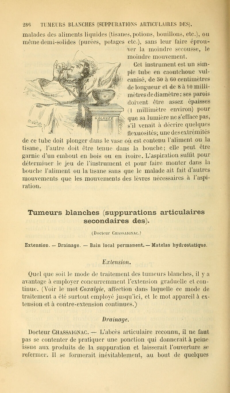 malades des aliments liquides (tisanes,potions, bouillons, etc.), ou même demi-solides (purées, potages etc.), sans leur faire éprou- ver la moindre secousse, le moindre mouvement. Cet instrument est un sim- ple tube en caoutchouc vul- canisé, de 50 à 60 centimètres de longueur et de 8 à 10 milli- mètres de diamètre; ses parois doivent être assez épaisses p (1 millimètre environ) pour que sa lumière ne s'efface pas, s'il venait à décrire quelques flexuosités; une des extrémités de ce tube doit plonger dans le vase où est contenu l'aliment ou la tisane, l'autre doit être tenue dans la bouche; elle peut être garnie d'un embout en bois ou en ivoire. L'aspiration suffit pour déterminer le jeu de l'instrument et pour faire monter dans la bouche l'aliment ou la tisane sans que le malade ait fait d'autres mouvements que les mouvements des lèvres nécessaires à l'aspi- ration. Tumeurs blanches (suppurations articulaires secondaires des). (Docteur Chassaignac.) Extension. — Drainage. — Bain local permanent. — Matelas hydrostatique. Extension. Quel que soit le mode de traitement des tumeurs blanches, il y a avantage à employer concurremment l'extension graduelle et con- tinue. (Voir le mot Coxalgie, affection dans laquelle ce mode de traitement a été surtout employé jusqu'ici, et le mot appareil à ex- tension et à contre-extension continues.) Drainage. Docteur Chassaignac. — L'abcès articulaire reconnu, il ne faut pas se contenter de pratiquer une ponction qui donnerait à peine issue aux produits de la suppuration et laisserait l'ouverture se refermer. Il se formerait inévitablement, au bout de quelques