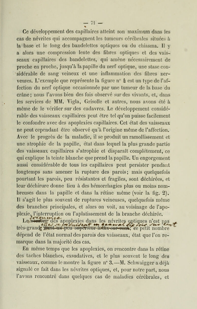 Ce développement des capillaires atteint son maximum dans les cas de névrites qui accompagnent les tumeurs cérébrales située- à la base et le long des bandelettes optiques ou du chiasma. Il y a alors une compression lente des fibres optiques et des vais- seaux capillaires des bandelettes, qui amène nécessairement de proche en proche, jusqu'à la papille du nerf optique, une stase con- sidérable de sang veineux et une inflammation des fibres ner- veuses. L'exemple que représente la figure n° l\ est un type de l'af- fection du nerf optique occasionnée par une tumeur de la base du crâne ; nous l'avons bien des fois observé sur des vivants, et, dans les services de MM. Vigla, Grisolle et autres, nous avons été à même de le vérifier sur des cadavres. Le développement considé- rable des vaisseaux capillaires peut être tel qu'on puisse facilement le confondre avec des apoplexies capillaires. Cet état des vaisseaux ne peut cependant être observé qu'à l'origine même de l'affection. Avec le progrès de la maladie, il se produit un ramollissement et une atrophie de la papille, état dans lequel la plus grande partie des vaisseaux capillaires s'atrophie et disparaît complètement, ce qui explique la teinte blanche que prend la papille. Un engorgement aussi considérable de tous les capillaires peut persister pendant longtemps sans amener la rupture des parois; mais quelquefois pourtant les parois, peu résistantes et fragiles, sont déchirées, et leur déchirure donne lieu à des hémorrhagies plus ou moins nom- breuses dans la papille et dans la rétine même (voir la fig. 2). Il s'agit le plus souvent de ruptures veineuses, quelquefois même des branches principales, et alors on voit, au voisinage de l'apo- plexiev l'interruption ou l'aplatissement de la branche déchirée. feî^rcles apoplexies dans les névrites optiques n'est lias _- tres-granqg ;B^gt^ffiqmrB^mT3:fflF^^ ee petit nombre dépend de l'état normal des parois des vaisseaux, état que l'on re- marque dans la majorité des cas. En même temps que les apoplexies, on rencontre dans la rétine des taches blanches, exsudatives, et le plus souvent le long des vaisseaux, comme le montre la figure n° 3.—M. Schwaigger a déjà signalé ce fait dans les névrites optiques, et, pour notre part, nous l'avons rencontré dans quelques cas de maladies cérébrales, et