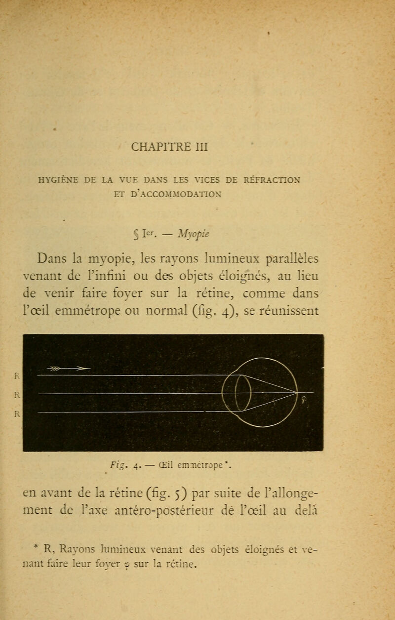 CHAPITRE III HYGIÈNE DE LA VUE DANS LES VICES DE RÉFRACTION ET D'ACCOMMODATION §le Myopie Dans la myopie, les rayons lumineux parallèles venant de l'infini ou des objets éloignés, au lieu de venir faire foyer sur la rétine, comme dans l'œil emmétrope ou normal (flg. 4), se réunissent Fis. Œil emmétrope . en avant de la rétine (ûg. 5) par suite de l'allonge- ment de l'axe antéro-postérieur dé l'œil au delà * R, Rayons lumineux venant des objets éloignés et ve- nant faire leur fover o sur la rétine.