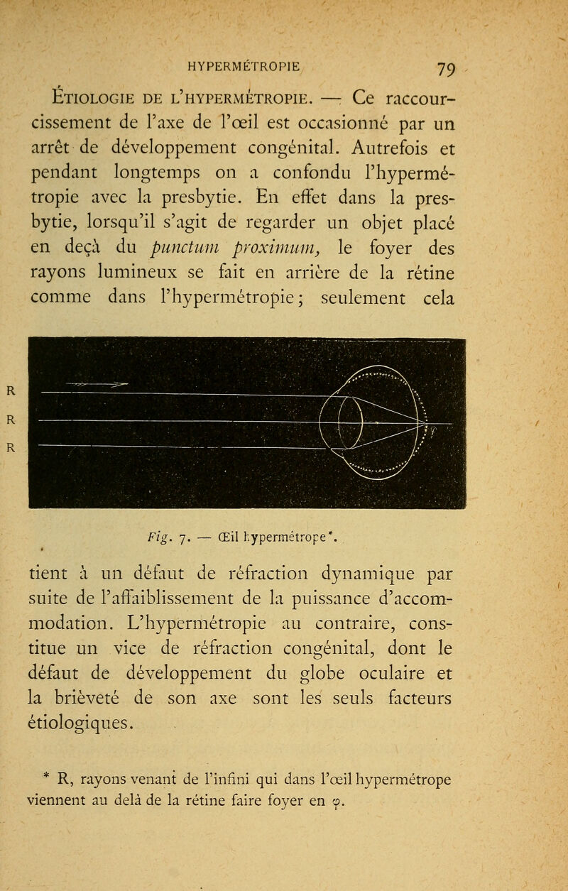 Etiologie de l'hypermétropie. —; Ce raccour- cissement de l'axe de l'œil est occasionné par un arrêt de développement congénital. Autrefois et pendant longtemps on a confondu l'hypermé- tropie avec la presbytie. En effet dans la pres- bytie, lorsqu'il s'agit de regarder un objet placé en deçà du punctum proximum, le foyer des rayons lumineux se fait en arrière de la rétine comme dans l'hypermétropie; seulement cela Flg. 7. Œil hypermétrope*. tient à un défaut de réfraction dynamique par suite de l'affaiblissement de la puissance d'accom- modation. L'hypermétropie au contraire, cons- titue un vice de réfraction congénital, dont le défaut de développement du globe oculaire et la brièveté de son axe sont les seuls facteurs étiologiques. * R, rayons venant de l'infini qui dans l'œil hypermétrope viennent au delà de la rétine faire foyer en o.