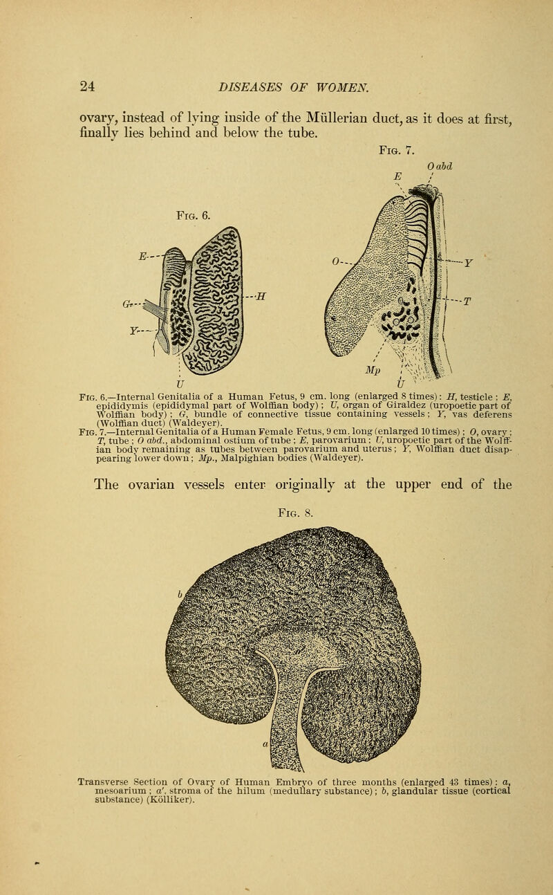 ovary, instead of lying inside of the Miillerian duct, as it does at first, finally lies behind and below the tube. Fig. 7. Oabd Fro. 6. —H r—Y Fig. 6.—Internal Genitalia of a Human Fetus, 9 cm. long (enlarged 8 times): H, testicle ; E, epididymis (epididymal part of Wolffian body); U, organ of Giraldez (uropoetic part of Wolffian body); O, bundle of connective tissue containing vessels: Y, vas deferens (Wolffian duct) (Waldeyer). Fig. 7.—Internal Genitalia of a Human Female Fetus, 9 cm. long (enlarged 10 times); 0, ovary; T, tube ; 0 abd., abdominal ostium of tube ; E, parovarium: U, uropoetic part of the Wolff- ian body remaining as tubes between parovarium and uterus; Y, Wolffian duct disap- pearing lower down; Mp., Malpighian bodies (Waldeyer). The ovarian vessels enter originally at the upper end of the Fig. 8. Transverse Section of Ovary of Human Embryo of three months (enlarged 43 times): a, mesoarium ; a', stroma of the hilum (medullary substance); b, glandular tissue (cortical substance) (Kolliker).