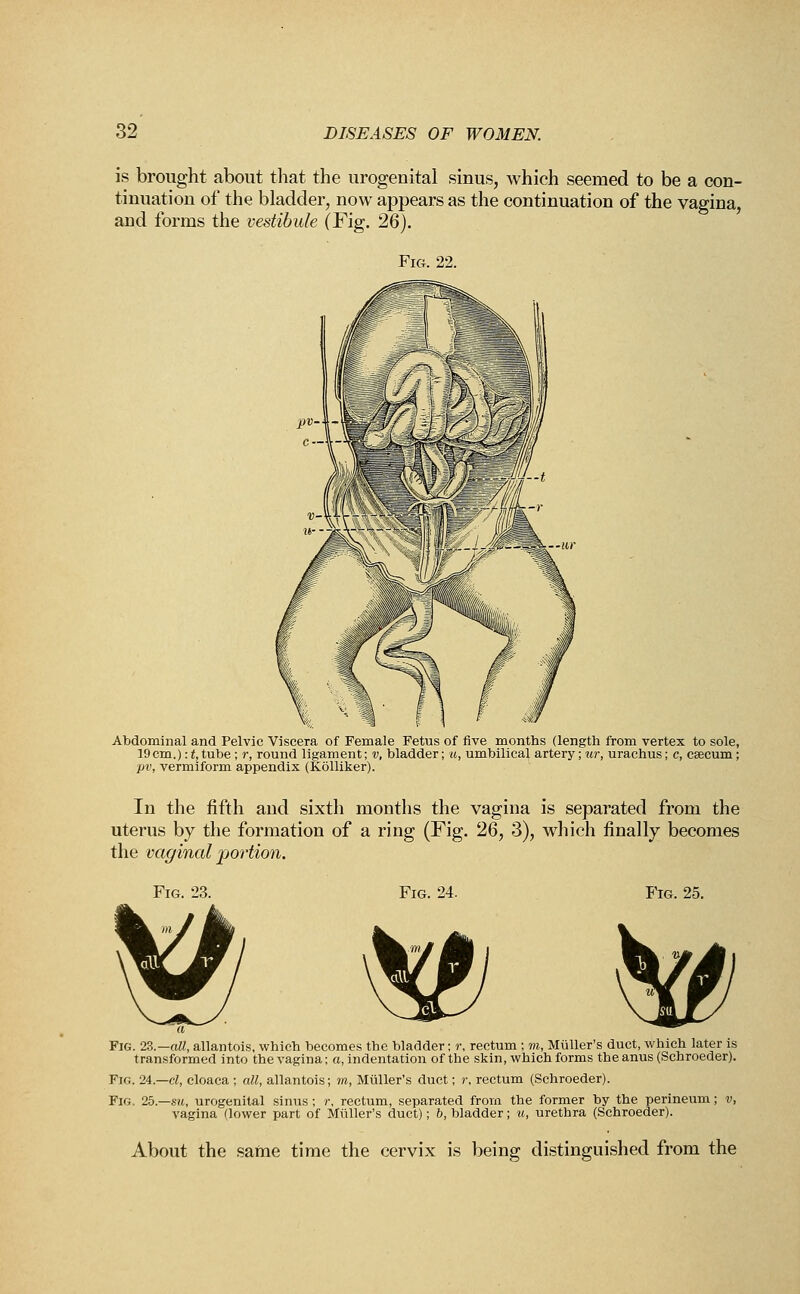 is brought about that the urogenital sinus, which seemed to be a con- tinuation of the bladder, now appears as the continuation of the vagina, and forms the vestibule (Fig. 26). Fig. 22. Abdominal and Pelvic Viscera of Female Fetus of five months (length from vertex to sole, 19cm.):t,tube ; r, round ligament; v, bladder; u, umbilical artery ;«r, urachus; c, caecum; pv, vermiform appendix (Kolliker). In the fifth and sixth months the vagina is separated from the uterus by the formation of a ring (Fig. 26, 3), which finally becomes the vaginal portion. Fig. 23. Fig. 24. Fig. 25. ® Fig. 23.— all, allantois, which becomes the bladder; r, rectum ; m, Miiller's duct, which later is transformed into the vagina; a, indentation of the skin, which forms the anus (Schroeder). Fig. 24.—cl, cloaca ; all, allantois; in, Miiller's duct; r, rectum (Schroeder). Fig. 25.—su, urogenital sinus; r, rectum, separated from the former by the perineum; v, vagina (lower part of Miiller's duct); b, bladder; u, urethra (Schroeder). About the same time the cervix is being distinguished from the