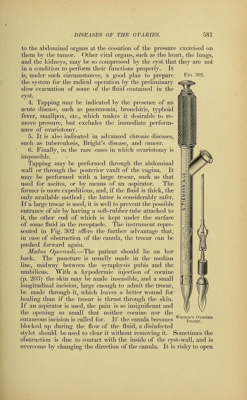 to the abdominal organs at the cessation of the pressure exercised on them by the tumor. Other vital organs, such as the heart, the lungs, and the kidneys, may be so compressed by the cyst that they are not in a condition to perform their functions properly. It is, under such circumstances, a good plan to prepare Fig. 302. the system for the radical operation by the preliminary slow evacuation of some of the fluid contained in the <t; cyst, 4. Tapping may be indicated by the presence of an acute disease, such as pneumonia, bronchitis, typhoid fever, smallpox, etc., which makes it desirable to re- move pressure, but excludes the immediate perform- ance of ovariotomy. 5. It is also indicated in advanced chronic diseases, such as tuberculosis, Bright's disease, and cancer. 6. Finally, in the rare cases in which ovariotomy is impossible. Tapping may be performed through the abdominal wall or through the posterior vault of the vagina. It may be performed with a large trocar, such as that used for ascites, or by means of an aspirator. The former is more expeditious, and, if the fluid is thick, the only available method; the latter is considerably safer. If a large trocar is used, it is well to prevent the possible entrance of air by having a soft-rubber tube attached to it, the other end of which is kept under the surface of some fluid in the receptacle. The instrument repre- sented in Fig. 302 offers the further advantage that, in case of obstruction of the canula, the trocar can be pushed forward again. Modus Operandi.—The patient should lie on her back. The puncture is usually made in the median line, midway between the symphysis pubis and the umbilicus. With a hypodermic injection of cocaine (p. 203) the skin may be made insensible, and a small longitudinal incision, large enough to admit the trocar, be made through it, which leaves a better wround for healing than if the trocar is thrust through the skin. If an aspirator is used, the pain is so insignificant and the opening so small that neither cocaine nor the cutaneous incision is called for. If the canula becomes WarrTroScarVarian blocked up during the flow of the fluid, a disinfected stylet should be used to clear it without removing it. Sometimes the obstruction is due to contact with the inside of the cyst-wall, and is overcome by changing the direction of the canula. It is risky to open