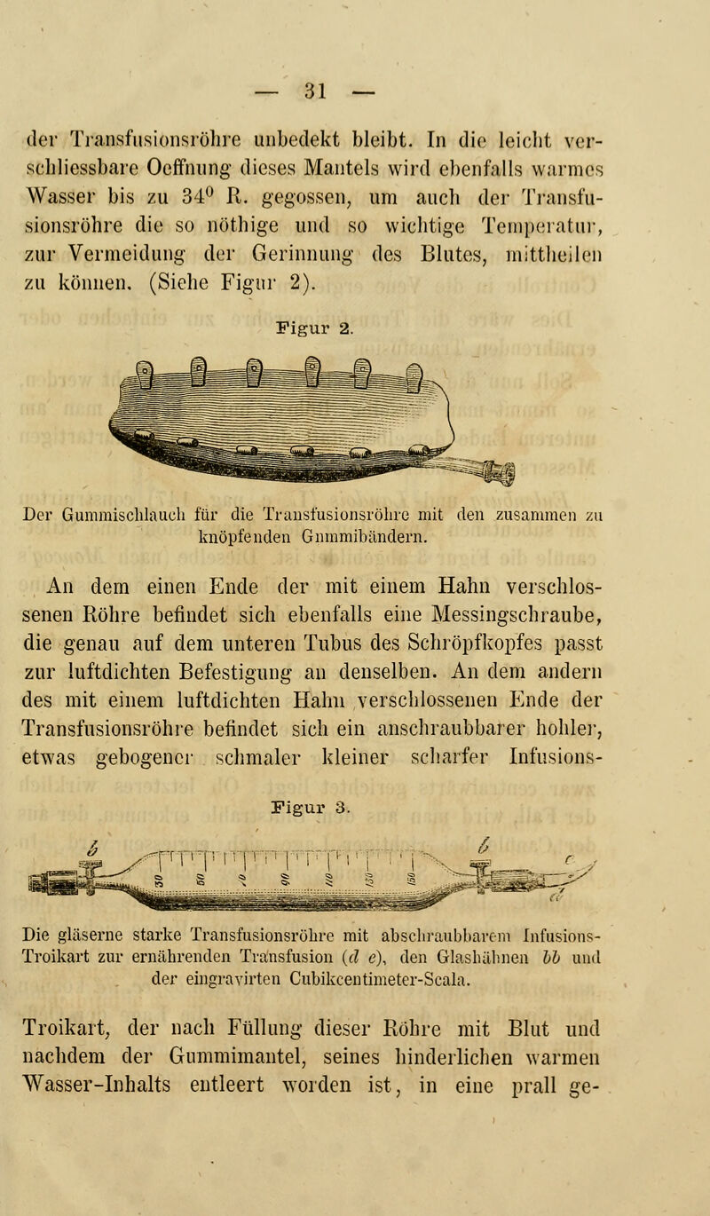 der Transfusionsröhre uubedekt bleibt. In die leicht ver- schliessbare Oeffnung dieses Mantels wird ebenfalls warmes Wasser bis zu 34° R. gegossen, um auch der Transfu- sionsröhre die so nöthige und so wichtige Temperatur, zur Vermeidung der Gerinnung des Blutes, mittheilen zu können. (Siehe Figur 2). Figur 2. Der Gummischlauch für die Transi'usionsröhre mit den zusammen zu knöpfenden Gmnmibändern. An dem einen Ende der mit einem Hahn verschlos- senen Röhre befindet sich ebenfalls eine Messingschraube, die genau auf dem unteren Tubus des Schröpfkopfes passt zur luftdichten Befestigung an denselben. An dem andern des mit einem luftdichten Hahn verschlossenen Ende der Transfusionsröhre befindet sich ein anschraubbarer hohler, etwas gebogener schmaler kleiner scharfer Infusions- 6 Figur 3. jTM-p f!pv p r'p rj Die gläserne starke Transfusionsröhre mit abschraubbarem Infusions- Troikart zur ernährenden Transfusion (d e\ den Glashähnen bh und der eingravirten Cubikcentimeter-Scala. Troikart, der nach Füllung dieser Röhre mit Blut und nachdem der Gummimantel, seines hinderlichen warmen Wasser-Inhalts entleert worden ist, in eine prall ge-