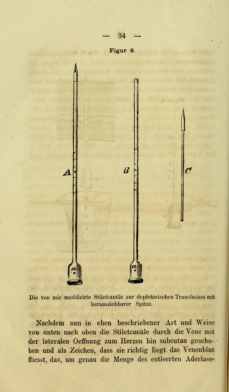 Figur 6. A. Die von mir modificirte Stiletcanüle zur depletorischen Transfusion mit herausziehbarer Spitze. Nachdem nun in eben beschriebener Art und Weise vou unten nach oben die Stiletcanüle durch die Vene mit der lateralen Oeffnung zum Herzen hin subcutan gescho- ben und als Zeichen, dass sie richtig liegt das Venenblut fliesst, das, um genau die Menge des entleerten Aderlass-