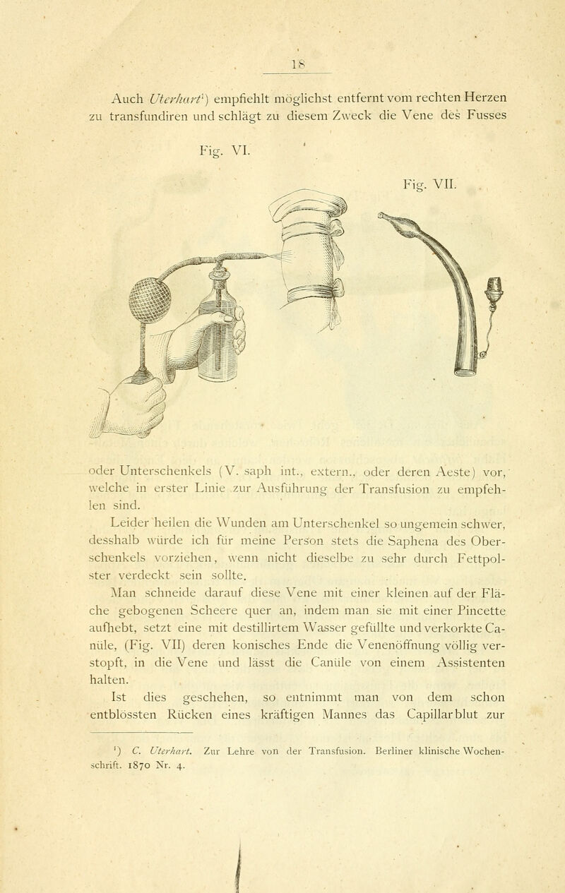 Auch Uterhart'') empfiehlt möglichst entfernt vom rechten Herzen zu transfundiren und schlägt zu diesem Zweck die Vene des Fusses Fie. VI. Fie. VII. oder Unterschenkels (V. saph int., extern., oder deren Aeste) vor,' welche in erster Linie .zur Ausführung der Transfusion zu empfeh- len sind. Leider heilen die Wunden am Unterschenkel so ungemein schwer, desshalb würde ich für meine Person stets die Saphena des Ober- schenkels vorziehen, wenn nicht dieselbe zu sehr durch Fettpol- ster verdeckt sein sollte. Man schneide darauf diese Vene mit einer kleinen auf der Flä- che gebogenen Scheere quer an, indem man sie mit einer Pincette aufhebt, setzt eine mit destillirtem Wasser gefüllte und verkorkte Ca- nüle, (Fig. VII) deren konisches Ende die Venenöffnung völlig ver- stopft, in die Vene und lässt die Canüle von einem Assistenten halten. Ist dies geschehen, so entnimmt man von dem schon entblössten Rücken eines kräftigen Mannes das Capillarblut zur ') C. Uterhart. Zur Lehre von der Transfusion. Berliner klinische Wochen- schrift. 1870 Nr. 4.