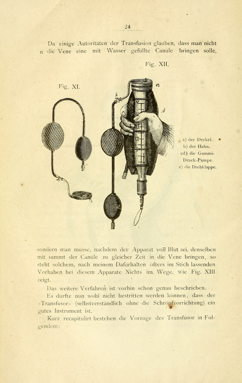 Da einige Autoritäten der Transfusion glauben, dass man nicht n die Vene eine mit Wasser gefüllte Canüle bringen solle, Fig. XII. Fig. XI a) der Deckel. b) der Hahn, cd) die Gummi- Druck-Pumpe. e) die Drehklappe. sondern man müsse, nachdem der Apparat voll Blut sei, denselben mit sammt der Canüle zu gleicher Zeil in die Vene bringen, so steht solchem, nach meinem Dafürhalten öfters im Stich lassenden Vorhaben bei diesem Apparate Nichts im. Wege, wie Fig. XIII zeigt. ■ . ' Das weitere Verfahren, ist vorhin schon genau beschrieben. Es dürfte nun wohl nicht bestritten Averden können, dass der «Transfusor« (selbstverständlich ohne die SchröQ^vorrichtung) ein gutes Instrument ist. Kurz recapitulirt bestehen die Vorzüge des Transfusor in Fol- g-endem: