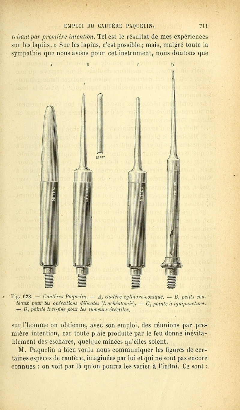 Irisant par première intention. Tel est le résultat de mes expériences sur les lapins. » Sur les lapins, c'est possible ; mais, malgré toute la sympathie que nous avons pour cet instrument, nous doutons que 'Fig. 628. — Cautères Paquelin. — A, cautère cylindro-conique. — B, petits cou- teaux pour les opérations délicates (trachéotomie). — C, pointe à ignipuncture. — D, pointe très-fine pour les tumeurs érectiles. sur l'homme on obtienne, avec son emploi, des réunions par pre- mière intention, car toute plaie produite par le feu donne inévita- blement des eschares, quelque minces qu'elles soient. M. Paquelin a bien voulu nous communiquer les figures de cer- taines espèces de cautère, imaginées par lui et qui ne sont pas encore connues : on voit par là qu'on pourra les varier à l'infini. Ce sont :