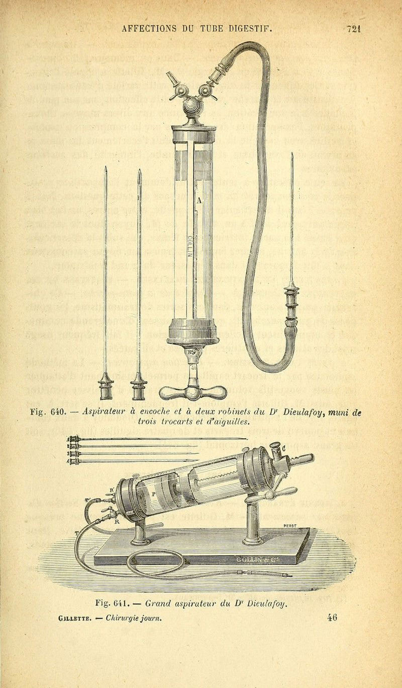 Fig. 640. — Aspirateur à encoche et à deux robinets du Dr Dieulafoy, muni de trois irocarts et d'aiguilles. Fig. 641. — Grand aspirateur du Dr Dieulafoy. Gjliette. — Chirurgie journ. 46