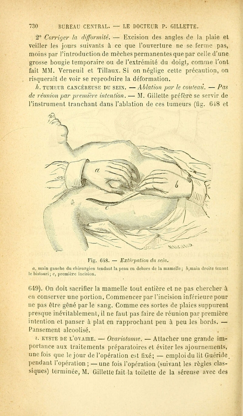 2° Corriger la difformité. — Excision des angles de la plaie et veiller les jours suivants à ce que l'ouverture ne se ferme pas, moins par l'introduction de mèches permanentes que par celle d'une grosse bougie temporaire ou de l'extrémité du doigt, comme font fait MM. Verneuil et Tillaux. Si on néglige cette précaution, on risquerait de voir se reproduire la déformation. h. tumeur cancéreuse du sein. —Ablation par le couteau. — Pas de réunion par première intention. — M. Gillette préfère se servir de l'instrument tranchant dans l'ablation de ces tumeurs (Qg. 6i8 et X\X^- xx Fig. 648. — Extirpation du sein. a, main gauche du chirurgien tendant la peau en dehors de la mamelle; ô,main droite tenant le bistouri; e, première incision. 649). On doit sacrifier la mamelle tout entière et ne pas chercher à en conserver une portion. Commencer par l'incision inférieure pour ne pas être gêné par le sang. Comme ces sortes de plaies suppurent presque inévitablement, il ne faut pas faire de réunion par première intention et panser à plat en rapprochant peu à peu les bords. — Pansement alcoolisé. i. kyste de l'ovaire. — Ovariotomie. — Attacher une grande im- portance aux traitements préparatoires et éviter les ajournements, une fois que le jour de l'opération est fixé; — emploi du lit Guéride. pendant l'opération; —une fois l'opération (suivant les règles clas- siques) terminée, M. Gillette fait la toilette de la séreuse avec des
