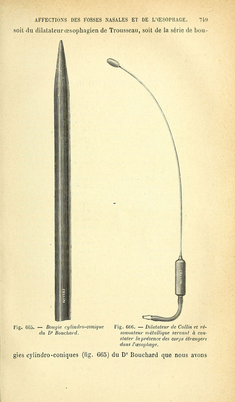 soit du dilatateur œsophagien de Trousseau, soit de la série de bou- Fig. 665. — Bougie cylindro-conique Fig. 666. — Dilatateur de Collin et ré- du D1 Bouchard. sonnateur métallique servant à con- stater la présence des corps étrangers dans l'œsophage. gies cylindro-coniques (fig. 665) du Dr Bouchard que nous avons