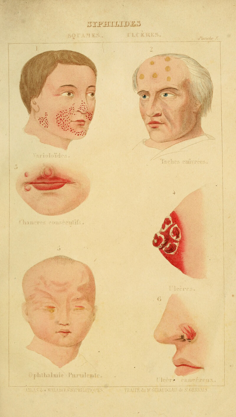 ^jFJim:pä&3 •I I ■ I I ! i^ Ä Im cJ'ivSr ■ i i 6 -41 11.1 Im i (■ l 11 IT; ,