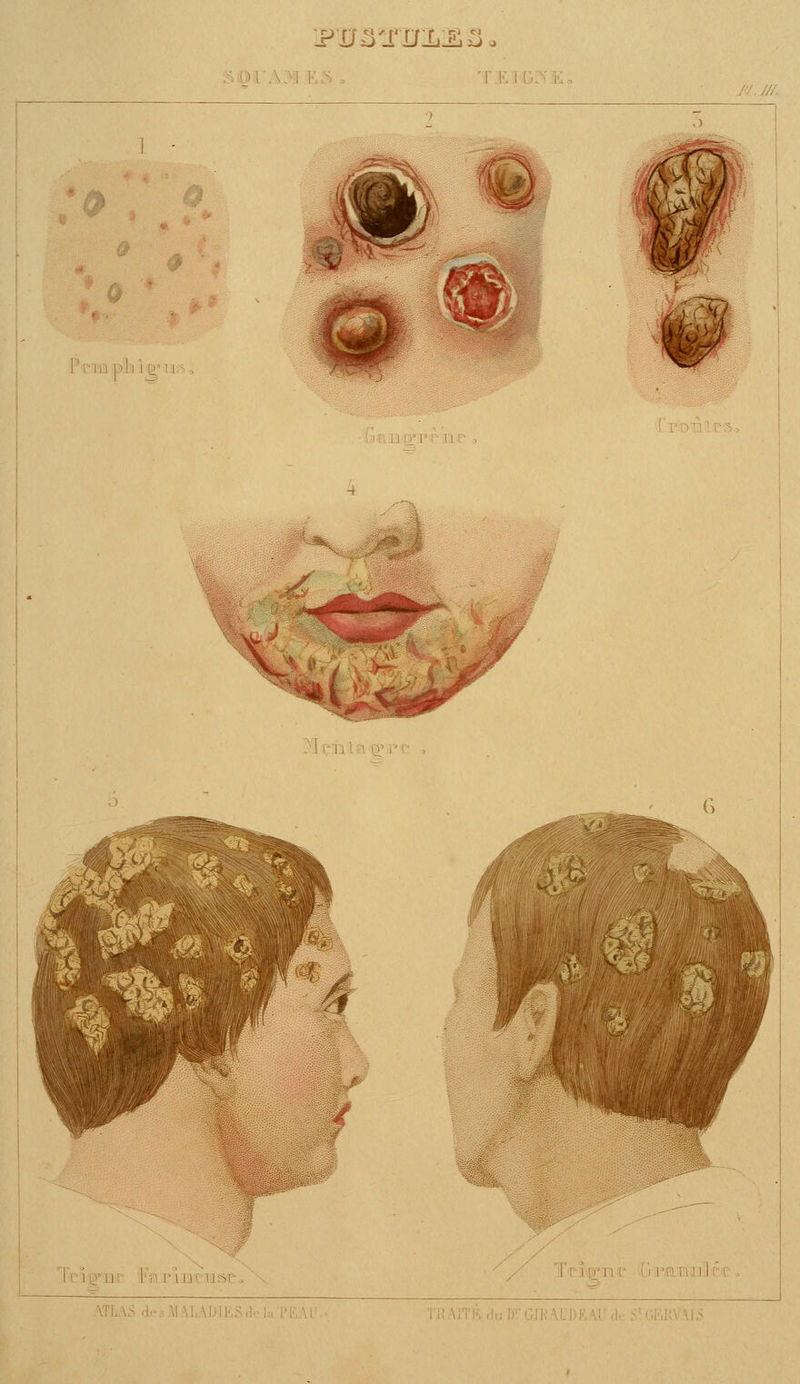 iPUâ^rcriLES \(ùk ;:! _ i $K5 -