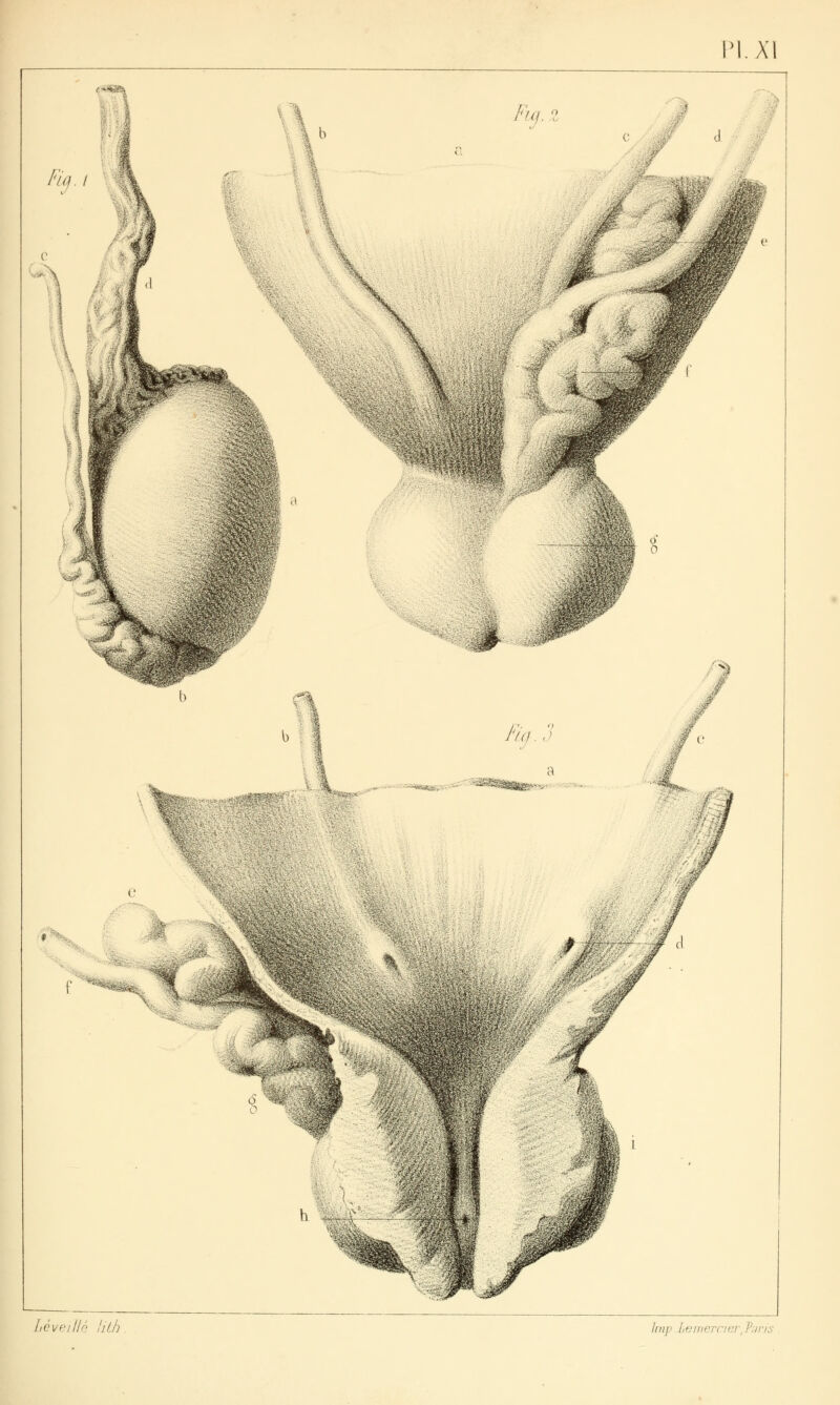 XI <-»*gîi LèveIHé lil.h Inip litniiprrii:i\ Par/s