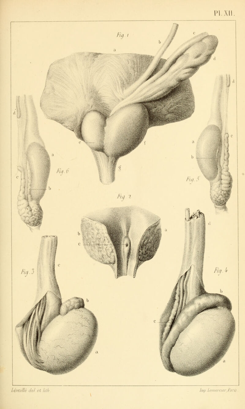 Pl.X dr %■ ^^ -■4| \Xi «4-ÏS»-<-^=SC-» Léveillè del et lith Imp Lemeivier,Pans.