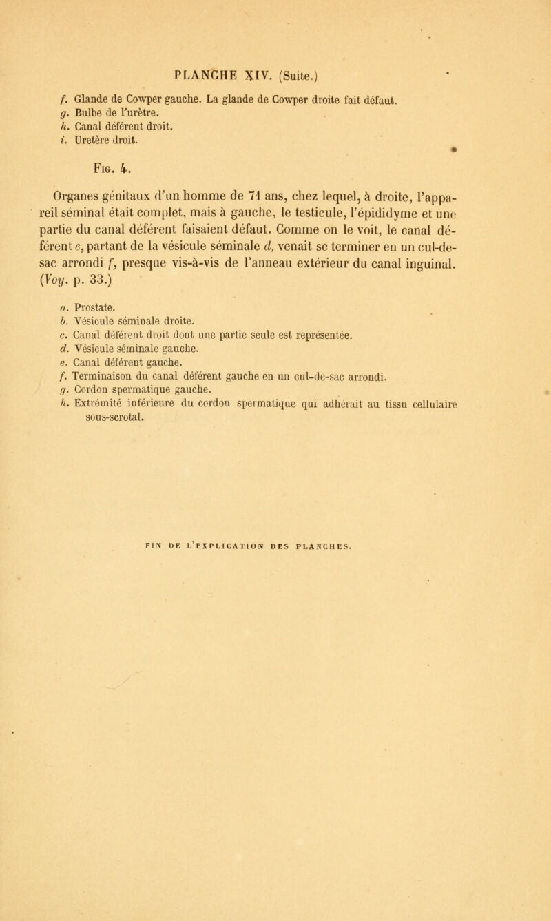 f. Glande de Cowper gauche. La glande de Gowper droite fait défaut. g. Bulbe de Turètre. h. Canal déférent droit. i. Uretère droit. FiG. 4. Organes génitaux d'un homme de 7i ans, chez lequel, à droite, l'appa- reil séminal était complet, mais à gauche, le testicule, l'épididyme et une partie du canal déférent faisaient défaut. Gomme on le voit, le canal dé- férent e, partant de la vésicule séminale d, venait se terminer en un cul-de- sac arrondi f, presque vis-à-vis de l'anneau extérieur du canal inguinal. {Yoy. p. 33.) a. Prostate. b. Vésicule séminale droite. c. Canal déférent droit dont une partie seule est représentée. d. Vésicule séminale gauche. e. Canal déférent gauche. /. Terminaison du canal déférent gauche en un cul-de-sac arrondi. g. Cordon spermatique gauche. h. Extrémité inférieure du cordon spermatique qui adhérait au tissu cellulaire sous-scrotal. FIN DE L EXPLICATION» DES PLA?îCHES.