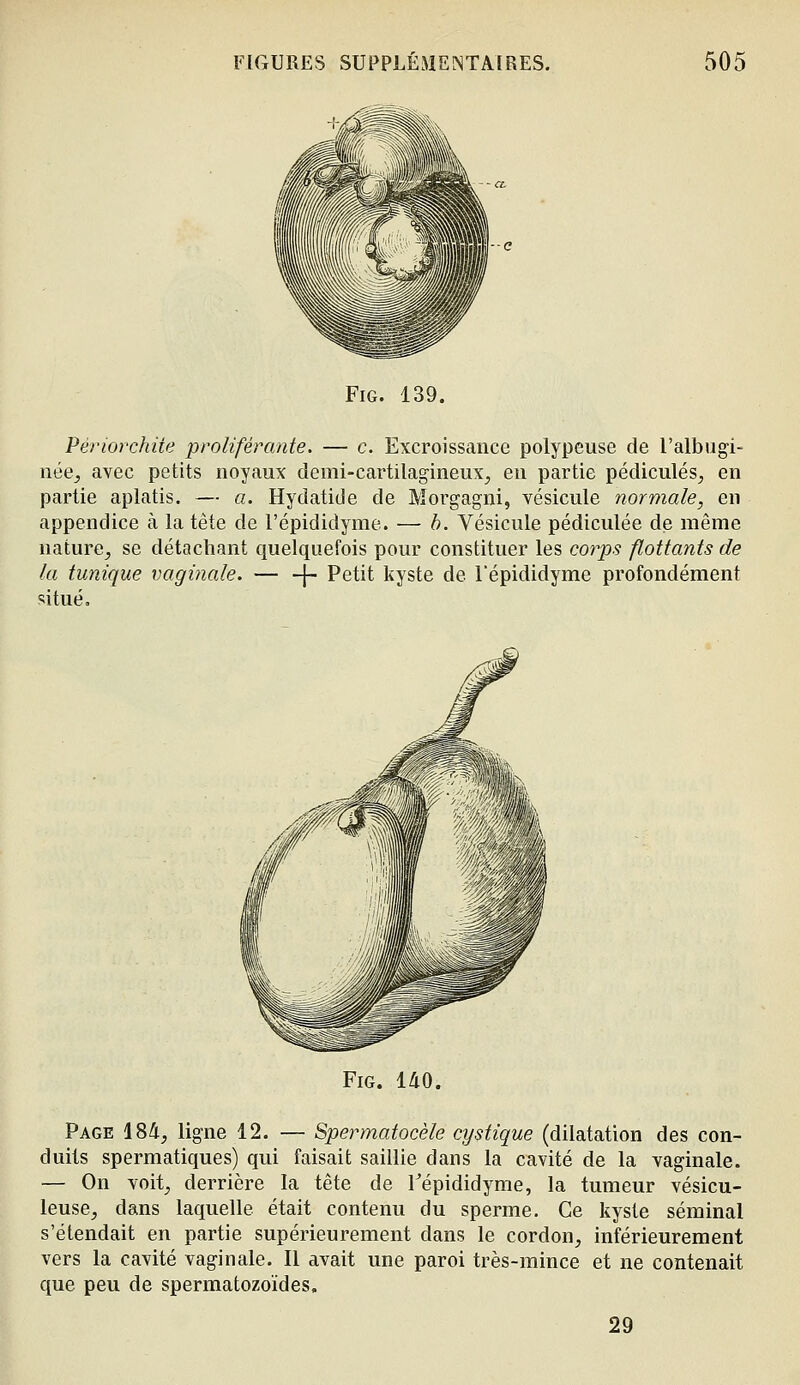 FiG. 139. Périorchite proliférante. — c. Excroissance polypeuse de l'albugi- née^ avec petits noyaux demi-cartilagineux^ en partie pédicules, en partie aplatis. — a. Hydatide de Morgagni, vésicule normale, en appendice à la tête de l'épididyme. — h. Vésicule pédiculée de même nature, se détachant quelquefois pour constituer les C07ys flottants de la tunique vaginale. — -\- Petit kyste de répididyme profondément situé. FiG. 140. Page 184, ligne 12. — Spermatocèle cystique (dilatation des con- duits spermatiques) qui faisait saillie dans la cavité de la vaginale. — On voit, derrière la tête de Tépididyme, la tumeur vésicu- leuse, dans laquelle était contenu du sperme. Ce kyste séminal s'étendait en partie supérieurement dans le cordon, inférieurement vers la cavité vaginale. Il avait une paroi très-mince et ne contenait que peu de spermatozoïdes. 29