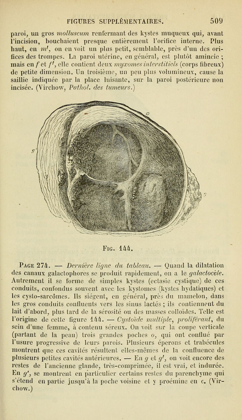 paroi^ uu gros molluscum renfermant des kystes muqueux qui, avant l'incision, bouchaient presque entièrement l'orifice interne. Plus haut, en m', on en voit un plus petit, semblable, près d'un des ori- fices des trompes. La paroi utérine, en général, est plutôt amincie ; mais en/et f, elle contient deux myxomes interstitiels (corps fibreux) de petite dimension. Un troisième, un peu plus volumineux, cause la saillie indiquée par la place luisante, sur la paroi postérieure non incisée. (Virchow, PothoL des tumeurs.) FiG. 144. Page 274. — Dernière ligne du tableau. — Quand la dilatation des canaux galactophores se produit rapidement, on a le galadochle. Autrement il se forme de simples kystes (ectasie cystique) de ces conduits, confondus souvent avec les kystomes (kystes hydatiques) et les cysto-sarcômes. Ils siègent, en général, près du mamelon, dans les gros conduits confluents vers les sinus lactés ; ils contiennent du lait d'abord, plus tard de la sérosité ou des masses colloïdes. Telle est l'origine de cette figure 144. — Cystdide multiple.^ proliférant, du sein d'une femme, à contenu séreux. On voit sur la coupe verticale (partant de la peau) trois grandes poches o, qui ont conflué par l'usure progressive de leurs parois. Plusieurs éperons et trabécules montrent que ces cavités résultent elles-mêmes de la confluence de plusieurs petites cavités antérieures. — En g et g', on voit encore des restes de l'ancienne glande, très-comprimée, il est vrai, et indurée. En y', se montrent en particulier certains restes du parenchyme qui s'étend en partie jusqu'à la poche voisine et y proémine en c. (Vir- chow.)