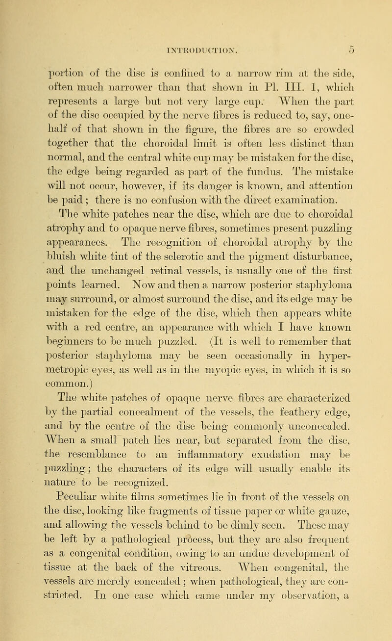 l^'■l'lU)l)liCTl()^'. 0 jioriioii oi tlie disc is coiilined to n, iuutow rim iit the side, often iiiucli iiari'OAver than that sliown in 1*L 111. 1, wliieli represents a hirge but not veiy large cup. When the pai't of the disc occupied by the nerve fibres is reduced to, say, one- half of that shown in the figm-e, the fibres are so crowded together that the choroidal limit is often less distinct than normal, and the central white cup may be mistaken for the disc, the edge being regarded as part of the fundus. The mistake will not occm-, however, if its danger is known, and attention be paid ; there is no confusion with the direct examination. The white patches near the disc, which are due to choroidal atrophy and to opaque nerve fibres, sometimes present puzzling- appearances. The recognition of choroidal atrophy by the bluish white tint of the sclerotic and the pigment disturbance, and the unchanged retinal vessels, is usually one of the first points learned. Now and then a narrow posterior staphyloma may surround, or almost surround the disc, and its edge may be mistaken for the edge of the disc, which then appears white with a red centre, an appearance vvith which I have known beginners to be much puzzled. (It is well to remember that ]30sterior staphyloma may be seen occasionally in hyper- metropic eyes, as well as in the myopic eyes, in which it is so common.) The white patches of opaque nerve fibres are characterized by the partial concealment of the vessels, the feathery edge, and by the centre of the disc being commonly unconcealed. When a small patch lies near, but separated from the disc, the resemblance to an inflammatory exudation may be puzzling; the characters of its edge wdll usually enable its nature to be recognized. Peculiar white films sometimes lie in front of the vessels on the disc, looking like fragments of tissue paper or w4iite gauze, and allowing the vessels behind to be dimly seen. These may be left by a pathological process, but they are also frequent as a congenital condition, owing to an undue development of tissue at the back of the vitreous. When congenital, the vessels are merely concealed; when pathological, they are con- stricted. In one case which came under my observation, a