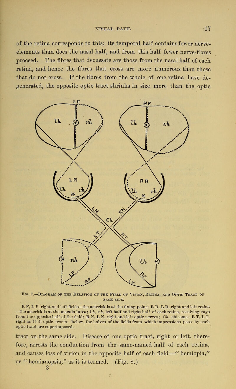 VISIJAL PATH. ■ir of the retina corresponds to this; its temporal half contains fewer nerve- elements than does the nasal half, and from this half fewer nerve-fibres proceed. The fibres that decussate are those from the nasal half of each retina, and hence the fibres that cross are more numerous than those that do not cross. If the fibres from the whole of one retina have de- generated, the opposite optic tract shrinks in size more than the optic LF RF Fig. 7.—Diagram of the Relation of the Field of Vision, Kbtina, and Optic Tract on each side. R F, L F, right and left fields—the asterisk is at the fixing point; R R, L R, right and left retina —the asterisk is at the macula lutea; l.h, r.h, left half and right half of each retina, receiving rays from the opposite half of the field; R N, L N, right and left optic nerves; Ch, chiasma; R T, L T, right and left optic tracts; below, the halves of the fields from which impressions pass by each optic tract are superimposed. tract on the same side. Disease of one optic tract, right or left, there- fore, arrests the conduction from the same-named half of each retina, and causes loss of vision in the opposite half of each field— hemiopia, or ''hemianopsia, as it is termed. (Fig. 8.)