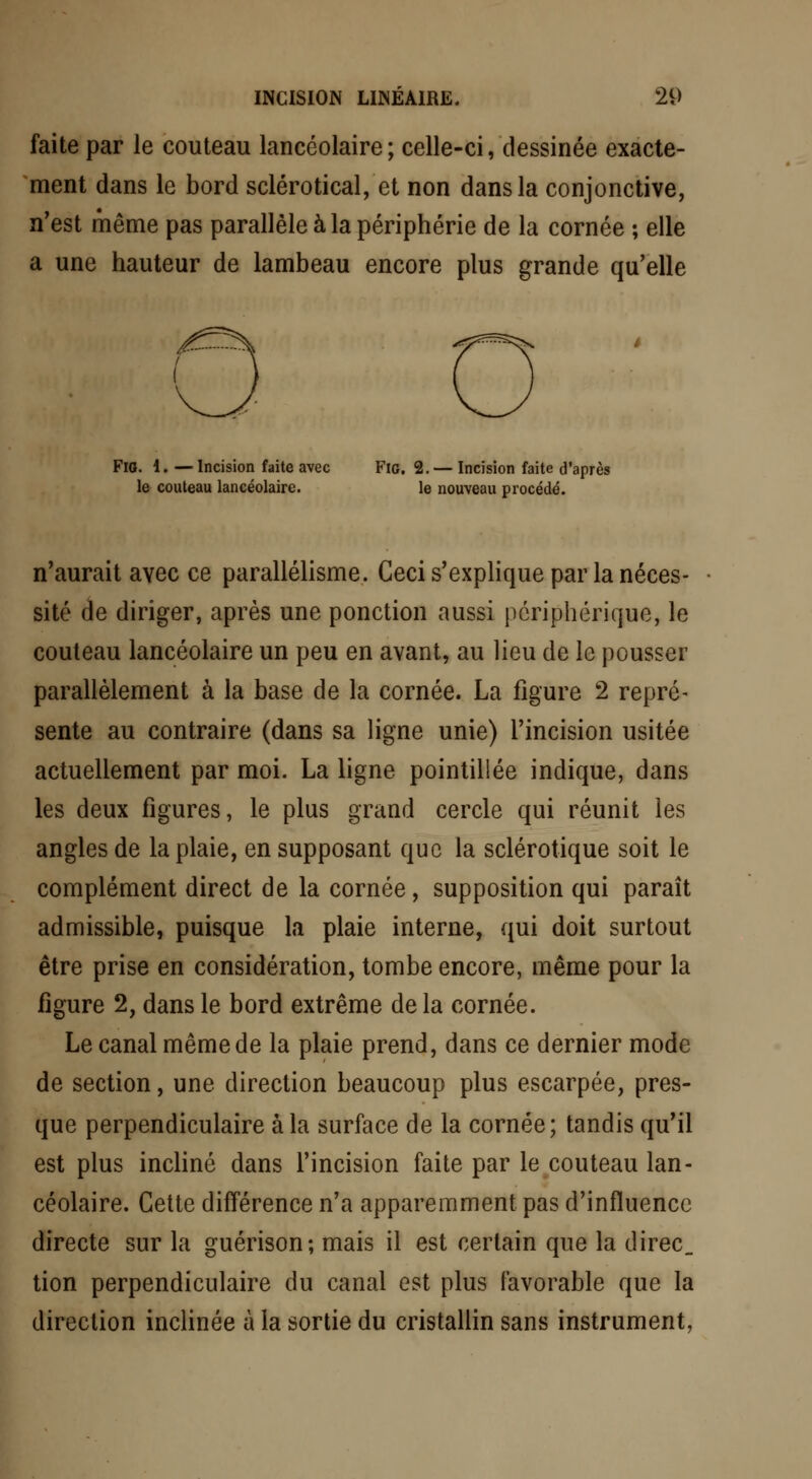 faite par le couteau lancéolaire ; celle-ci, dessinée exacte- ment dans le bord sclérotical, et non dans la conjonctive, n'est même pas parallèle à la périphérie de la cornée ; elle a une hauteur de lambeau encore plus grande qu'elle FiG. 1. — Incision faite avec Fie. 2. — Incision faite d'après le couteau lancéolaire. le nouveau procédé. n'aurait avec ce parallélisme. Ceci s'explique par la néces- sité de diriger, après une ponction aussi périphérique, le couteau lancéolaire un peu en avant, au lieu de le pousser parallèlement à la base de la cornée. La figure 2 repré- sente au contraire (dans sa ligne unie) l'incision usitée actuellement par moi. La ligne pointillée indique, dans les deux figures, le plus grand cercle qui réunit les angles de la plaie, en supposant que la sclérotique soit le complément direct de la cornée, supposition qui paraît admissible, puisque la plaie interne, qui doit surtout être prise en considération, tombe encore, même pour la figure 2, dans le bord extrême delà cornée. Le canal même de la plaie prend, dans ce dernier mode de section, une direction beaucoup plus escarpée, pres- que perpendiculaire à la surface de la cornée; tandis qu'il est plus incliné dans l'incision faite par le couteau lan- céolaire. Cette différence n'a apparemment pas d'influence directe sur la guérison; mais il est certain que la direc_ tion perpendiculaire du canal est plus favorable que la direction inclinée à la sortie du cristallin sans instrument,