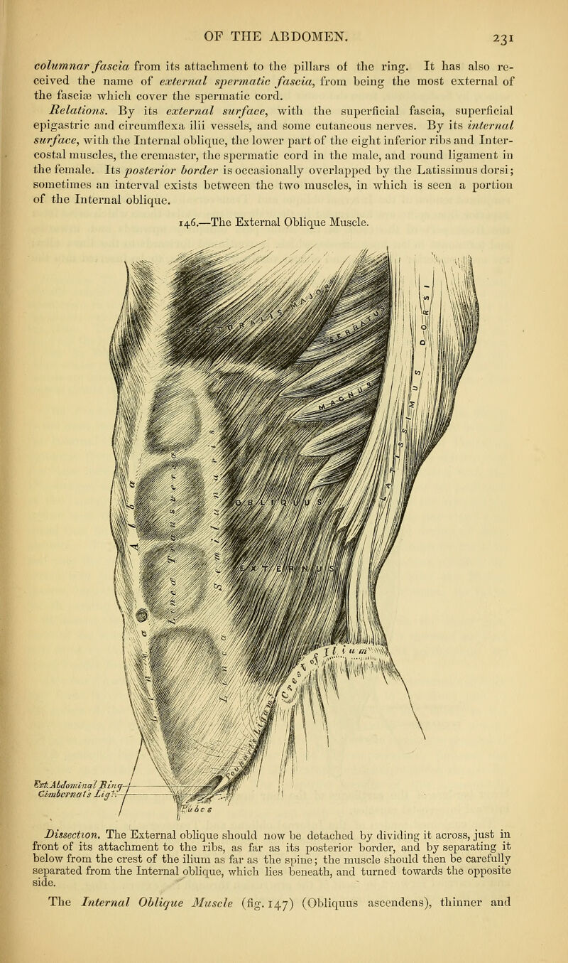 columnar fascia from its attachment to the pillai-s of the ring. It has also re- ceived the name of external spermatic fascia, from being tlie most external of the fascia3 whicli cover tlie spermatic cord. Relations. By its external surface, with the superficial fascia, superficial epigastric and circumflexa ilii vessels, and some cutaneous nerves. By its internal surface, with the Internal oblique, the lower part of the eight inferior ribs and Inter- costal muscles, the cremaster, the spermatic cord in the male, and round ligament in the female. Its posterior border is occasionally overlapped by the Latissimus dorsi; sometimes an interval exists between the two muscles, in which is seen a portion of the Internal oblique. 146,—The External Oblique Muscle. ^lit.Abdo7iu>i(il JRirLq-'r— Clmiernat's Ligl—I— I Dissection. The External oblique should now be detached by dividing it across, just in front of its attachment to the ribs, as far as its posterior border, and by separating it below from the crest of the ilium as far as the spine; the muscle should then be carefully separated from the Internal oblique, which lies beneath, and turned towards the opposite side. ' The Internal Oblique Muscle (fig. 147) (Obliquus ascendens), thinner and