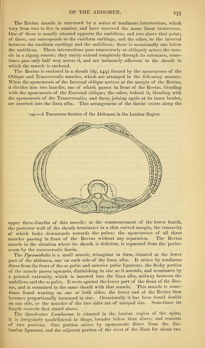 The Rectus muscle is traversed by 11 series of tendinous intersections, which vary from two io five in number, and have received the name lineaa transversoe. One of these is usually situated opposite the umbilicus, and two above that point; of these, one corresponds to the ensiform cartilage, and the other, to the interval between the ensiform cartilage und the umbilicus; there is occasionally one below the umbilicus. These intersections pass transversely or obliquely across the mus- cle in a zigzag course; they rarely extend completely through its substance, some- times pass only half way across it, and are intimately adherent to the sheath in which the muscle is enclosed. The Rectus is enclosed in a sheath (fig. 149) formed by the aponeuroses of the Oblique and Transversalis muscles, which are arranged in the following manner. When the aponeurosis of the Internal oblique arrives at the margin of the Rectus, it divides into two lamellae, one of which passes in front of the Rectus, blending with the aponeurosis of the Extei'nal oblique; the other, behind it, blending with the aponeurosis of the Transversalis; and these, joining again at its inner border, are inserted into the linea alba. This arrangement of the fascia exists along the 149.—A Transverse Section of the Abdomen in the Lumbar Region. upper three-fourths of this muscle; at the commencement of the loAver fourth, the posterior wall of the sheath terminates in a thin curved margin, the concavity of which looks downwards towards the pubes; the aponeuroses of all three muscles passing in front of the Rectus without any separation. The Rectus muscle in the situation where its sheath is deficient, is separated from the perito- neum by the transversalis fascia. The Pyramidalis is a small muscle, triangular in form, situated at the lower part of the abdomen, one on each side of the linea alba. It arises by tendinous fibres from the front of the OS pubis and anterior pubic ligament; the fleshy portion of the muscle passes upwards, diminishing in size as it ascends, and terminates by a pointed extremity, which is inserted into the linea alba, midway between the umbilicus and the os pubis. It rests against the lower part of the front of the Rec- tus, and is contained in the same sheath with that muscle. This muscle is some- times found wanting on one or both sides; the lower end of the Rectus then becomes proportionally increased in size. Occasionally it has been found double on one side, or the muscles of the two sides are of unequal size. Sometimes its length exceeds that stated above. The Quadratus Lumhorum is situated in the lumbar region of the spine, it is irregularly quadrilateral in shape, broader below than above, and consists of two portions. One portion arises by aponeurotic fibres from the ilio- lumbar ligament, and the adjacent portion of the crest of the ilium for about two