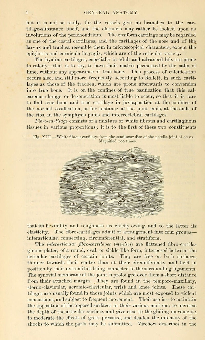 but it is Bot so really, for the vessels give no branches to the car- tilage-substance itself, and the channels may rather be looked upon as involutions of the perichondriiim. The ensiform cartilage may be regarded a.s one of the costal cartilages, and the cartilages of the nose and of the_ larynx and trachea resemble them in microscopical characters, except the epiglottis and cornicula laryngis, which are of the reticular variety. The hyaline cartilages, especially in adult and advanced life, are prone to calcify—that is to say, to have their matrix permeated by the salts of lime, without any appearance of true bone. This process of calcification occurs also, and still more frequently according to EoUett, in such carti- lages as those of the trachea, which are prone afterwards to conversion into true bone. It is on the confines of true ossification that this cal- careous change or degeneration is most liable to occur, so that it is rare to find true bone and true cartilage in juxtaposition at the confines of the normal ossification, as for instance at the joint ends, at the ends of the ribs, in the symphysis pubis and intervertebral cartilages. Fihro-cartilage consists of a mixture of white fibrous and cartilaginous tissues in various proportions; it is to the first of these two constituents Fig. XIII.—White fibrous cartilage ti-om the semihinar disc of the patella joint of an o.x. Mao'nified loo times. that its flexibility and toughness are chiefly owing, and to the latter its elasticity. The fibro-cartilages admit of arrangement into four groups— interarticular, connecting, circumferential, and stratiform. The interarticular fibro-cartilages [menisci] are flattened fibro-cartila- ginous plates, of a round, oval, or sickle-like form, interposed between the articular cartilages of certain joints. They are free on both surfaces, thinner towards their centre than at their circumference, and held in position by their extremities being connected to the surrounding ligaments. The synovial membrane of the joint is prolonged over them a short distance from their attached margin. ^ They are found in the temporo-maxillary, sterno-clavicular, acromio-clavicular, wrist and knee joints. These car- tilages are usually found in those joints which are most exposed to violent concussions, and subject to frequent movement. Their use is—to maintain the apposition of the opposed surfaces in their various motions; to increase the depth of the articular surface, and give ease to the gliding movement; to moderate the effects of great pressure, and deaden the intensity of the shocks to which the parts may be submitted. Virchow describes in the