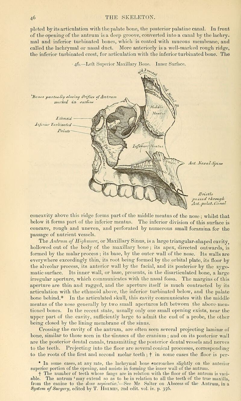 pleted by its articulation with the palate bone, the postei-ior palatine canal. In front of the opening of the antrum is a deep groove, converted into a caiial by the lachry- mal and inferior turbinated bones, which is coated with mucous membrane, and called the lachrymal or nasal duct. More anteriorly is a well-marked rough ridge, the infei'ior turbinated crest, for articulation with the inferior turbinated bone. The • 46.—Left Superior Maxillary Boue. Inner Surface. 'io»Aj rKfi-tta^llu closL-iiq O'i'iyi^ce of Antra. paused through A'llt-pci'lat. Ca.?ub7. concavity above this ridge forms part of the middle meatus of the nose ; whilst that below it forms part of the inferior meatus. The inferior division of this surface is concave, rough and uneven, and perforated by numerous small foramina for the passage of nutrient vessels. The Antrum of Highmore, or Maxillary Sinus, is a large triangular-shaped cavity hollowed out of the body of the maxillary bone ; its apex, directed outwards, is formed by the malar jorocess ; its base, by the outer wall of the nose. Its walls are everywhere exceedingly thin,'its root being formed by the orbital plate, its floor by the alveolar process, its anterior wall by the facial, and its posterior by the zygo- matic surface. Its inner wall, or base, presents, in the disarticulated bone, a large irregular aperture, which communicates with the nasal fossa. The margins of this aperture are thin and ragged, and the aperture itself is much contracted by its articulation with the ethmoid above, the inferior turbinated below, and the palate bone behind.* In the articulated s-kull, this cavity communicates with the middle meatus of the nose generally by two small apertures left between the above-men- tioned bones. In the recent state, usually only one small opening exists, near the upper part of the cavity, sufGciently large to admit the end of a jirobe, the other being closed by the lining membrane of the sinus. Crossing the cavity of the antrum, are often seen several projecting laminte of bone, similar to those seen in the sinuses of the cranium; and on its posterior wall are the posterior dental canals, transmitting the posterior dental vessels and nerves to the teeth. Projecting into the floor are several conical processes, corresponding to the roots of the first and second molar teeth ; f in some cases the floor is per- * In some cases, at any rate, the lachrymal hone encroaches slightly on the anterior superior portion of the opening, and assists in forming the inner wall of the antrum. f The numher of teeth whose fangs are in relation with the floor of the antrum is vaii- ahle. The antrum 'raaj^ extend so as to he in relation to all the teeth of the true maxilla, from the canine to the dens siipientio!.^—See Mr, Salter on Ahscess of the Antrum, in a System of Swyery, edited hy T. HoiMES, 2nd edit. vol. iv. p. 356.