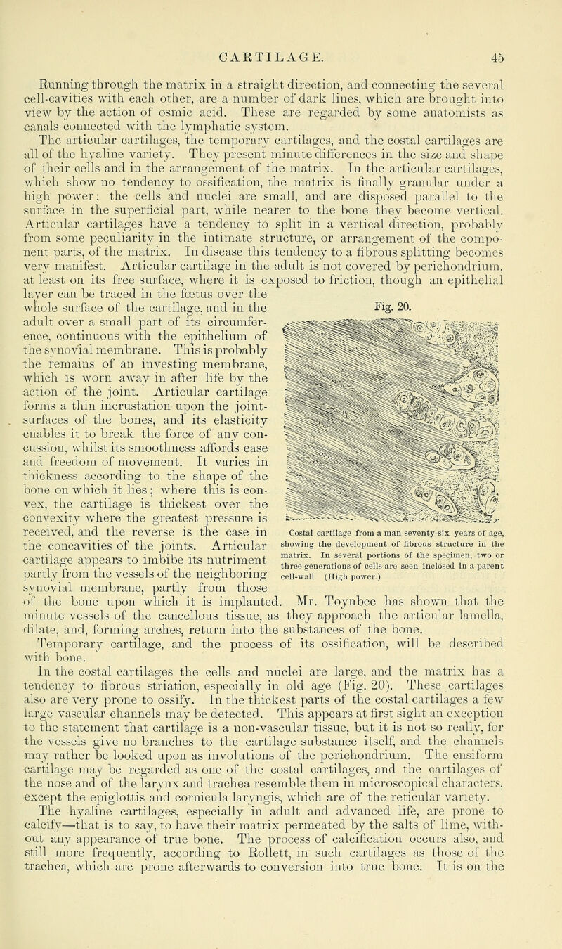 Fig. 20. T5 ,1,! Eunning througli the matrix in a straight direction, and connecting the several cell-cavities with each other, are a number of dark lines, which are brought into view by the action of osmic acid. These are regarded by some anatomists as canals connected with the lymphatic system. The articular cartilages, the temporary cartilages, and the costal cartilages are all of the hyaline variety. They present minute differences in the size and shape of their cells and in the arrangement of the matrix. In the articular cartilages, which show no tendency to ossification, the matrix is finally granular under a high power; the cells and nuclei are small, and are disposed parallel to the surface in the superficial part, while nearer to the bone they become vertical. Articular cartilages have a tendency to split in a vertical direction, probably from some peculiarity in the intimate structure, or arrangement of the compo- nent parts, of the matrix. In disease this tendency to a fibrous splitting becomes very manifest. Articular cartilage in the adult is not covered by perichondrium, at least on its free surface, where it is exposed to friction, though an epithelial layer can be traced in the foetus over the whole surface of the cartilage, and in the adult over a small part of its circumfer- ence, continuous with the epithelium of the synovial membrane. This is probably the remains of an investing membrane, which is worn away in after life by the action of the joint. Articular cartilage forms a thin incrustation upon the joint- surfaces of the bones, and its elasticity enables it to break the force of any con- cussion, whilst its smoothness affords ease and freedom of movement. It varies in thickness according to the shape of the bone on which it lies ; where this is con- vex, the cartilage is thickest over the convexity where the greatest pressure is received, and the reverse is the case in the concavities of the joints. Articular cartilage appears to imbibe its nutriment partly from the vessels of the neighboring synovial membrane, partly from those of the bone upon which it is implanted. Mr. Toynbee has shown that the minute vessels of the cancellous tissue, as they approach the articular lamella, dilate, and, forming arches, return into the substances of the bone. Temporary cartilage, and the process of its ossification, will be described with bone. In the costal cartilages the cells and nuclei are large, and the matrix has a tendency to fibrous striation, especially in old age (Fig. 20), These cartilages also are very prone to ossify. In the thickest parts of the costal cartilages a few large vascular channels may be detected. This appears at first sight an exception to the statement that cartilage is a non-vascular tissue, but it is not so really, for the vessels give no branches to the cartilage substance itself, and the channels may rather be looked upon as involutions of the perichondrium. The ensiform cartilage may be regarded as one of the costal cartilages, and the cartilages of the nose and of the larynx and trachea resemble them in microscopical characters, except the epiglottis and cornicula laryngis, which are of the reticular variety. The hyaline cartilages, especially in adult and advanced life, are prone to ■calcify—that is to say, to have their matrix permeated by the salts of lime, with- out any appearance of true bone. The process of calcification occurs also, and still more frequently, according to Rollett, in such cartilages as those of the trachea, which are prone afterwards to conversion into true bone. It is on the Costal cartilage from a man seventy-six years of age, showing the development of fibrous structure in the matrix. In several portions of the specimen, two or three generations of cells are seen inclosed in a parent cell-wall. (High power.)