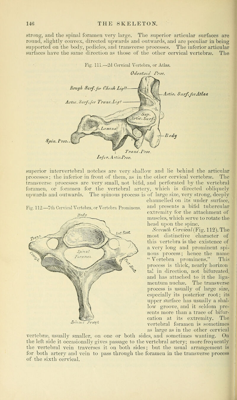 strong, and tlie spinal foramen very large. The superior articular surfaces are round, sliglitly convex, directed upwards and outwards, and are peculiar in being M supported on the body, pedicles, and transverse processes. The inferior articular * surfaces have the same direction as those of the other cervical vertebras. The Fig. 111.—2d Cervical Vertebra, or Atlas. 0(/o ntoiJ froc. Rovcfh Surf. for OAeeA Li(f^ A.rtLc. Swrf.for Trajis.Liif* Spin. Froc. J Trans .Proe. Imfcr.^A rtic.Ppoc. Bodv. superior intervertebral notches are very shallow and lie behind the articular processes; the inferior in front of them, as in the other cervical vertebrae. The transverse processes are very small, not bifid, and perforated by the vertebral foramen, or foramen for the vertebral artery, which is directed obliquely upwards and outwards. The spinous process is of large size, very strong, deeply channelled on its under surface, Fio-.112.—7tli Cervical Vertebra, or Vertebra Prominens. and presents a bifid tubercular extremity for the attachment of muscles, which serve to rotate the head upon the spine. Seventh Cervical (Fig. 112). The most distinctive character of this vertebra is the existence of a very long and prominent spi- nous process; hence the name  Vertebra prominens. This process is thick, nearly horizon tal in direction, not bifurcated, and has attached to it the liga- mentum nuchee. The transverse process is usually of large size, especially its posterior root; its upper stirface has usually a shal- low groove, and it seldom pre- sents more than a trace of bifur- cation at its extremity. The vertebral foramen is sometimes as large as in the other cervical vertebrae, usually smaller, on one or both sides, and sometimes wanting. On the left side it occasionally gives passage to the vertebral artery; more frequently the vertebral vein traverses it on both sides; but the usual arrangement is for both artery and vein to pass through the foramen in the transverse process of the sixth cervical. Procefs