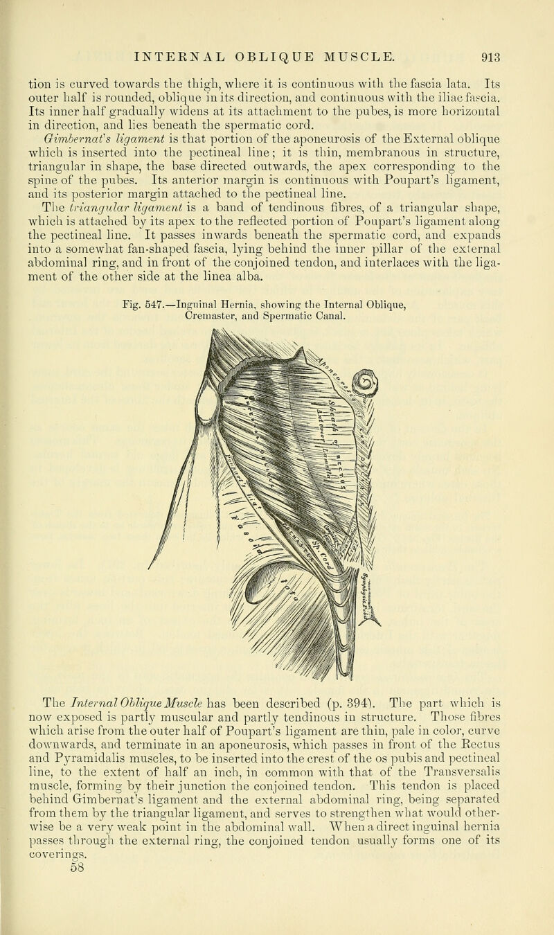 tioii is curved towards the thigh, where it is continuous with the fascia lata. Its outer half is rounded, oblique in its direction, and continuous with the iliac fapcia. Its inner half gradually widens at its attachment to the pubes, is more horizontal in direction, and lies beneath the spermatic cord. Qimhernais ligament is that portion of the aponeurosis of the External oblique which is inserted into the pectineal line; it is thin, membranous in structure, triangular in shape, the base directed outwards, the apex corresponding to the spine of the pubes. Its anterior margin is continuous with Poupart's ligament, and its posterior margin attached to the pectineal line. The triangular ligament is a band of tendinous fibres, of a triangular shape, which is attached by its apex to the reflected portion of Poupart's ligament along the pectineal line. It passes inwards beneath the spermatic cord, and expands into a somewhat fan-shaped fascia, lying behind the inner pillar of the external abdominal ring, and in front of the conjoined tendon, and interlaces with the liga- ment of the other side at the linea alba. Fig. 547.—Inguinal Hernia, showing the Internal Oblique, Cremaster, and Spermatic Canal. b The Internal Oblique Muscle has been described (p. 394). The part which is now exposed is partly muscular and partly tendinous in structure. Those fibres which arise from the outer half of Poupart's ligament are thin, pale in color, curve downwards, and terminate in an aponeurosis, which passes in front of the Rectus and Pyramidalis muscles, to be inserted into the crest of the os pubis and pectineal line, to the extent of half an inch, in common with that of the Transversalis muscle, forming by their junction the conjoined tendon. This tendon is placed behind Gimbernat's ligament and the external abdominal ring, being separated from them by the triangular ligament, and serves to strengthen what would other- wise be a very weak point in the abdominal wall. When a direct inguinal hernia passes through the external ring, the conjoined tendon usually forms one of its coverings. 58