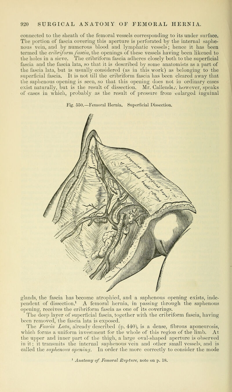 connected to the slieatli of the femoral vessels corresponding to its under surface. The portion of fascia covering this aperture is perforated by the internal saphe- nous vein, and by numerous blood and lymphatic vessels; hence it has been termed the cribriform fascia^ the openings of these vessels having been likened to the holes in a sieve. The cribriform fascia adheres closely both to the superficial fascia and the fascia lata, so that it is described by some anatomists as a part of the fascia lata, but is usually considered (as in this work) as belonging to the superficial fascia. It is not till the cribriform fascia has been cleared away that the saphenous opening is seen, so that this opening does not in ordinary cases exist naturally, but is the result of dissection. Mr. Callenda/. however, speaks of cases in which, probably as the result of pressure from enlarged inguinal Fig. 650.—Femoral Hernia. Superficial Dissection. glands, the fascia has become atrophied, and a saphenous opening exists, inde- pendent of dissection.^ A femoral hernia, in passing through the saphenous opening, receives the cribriform fascia as one of its coverings. The deep layer of superficial fascia, together with the cribriform fascia, having been removed, the fascia lata is exposed. The Fascia Lata^ already described (p. 440), is a dense, fibrous aponeurosis, which forms a uniform investment for the whole of this region of the limb. At the upper and inner part of the thigh, a large oval-shaped aperture is observed in it; it transmits the internal saphenous vein and other small vessels, and is called the saphenous opening. In order the more correctly to consider the mode ' Anatomy of Femoral Rupture^ note on p. 18.