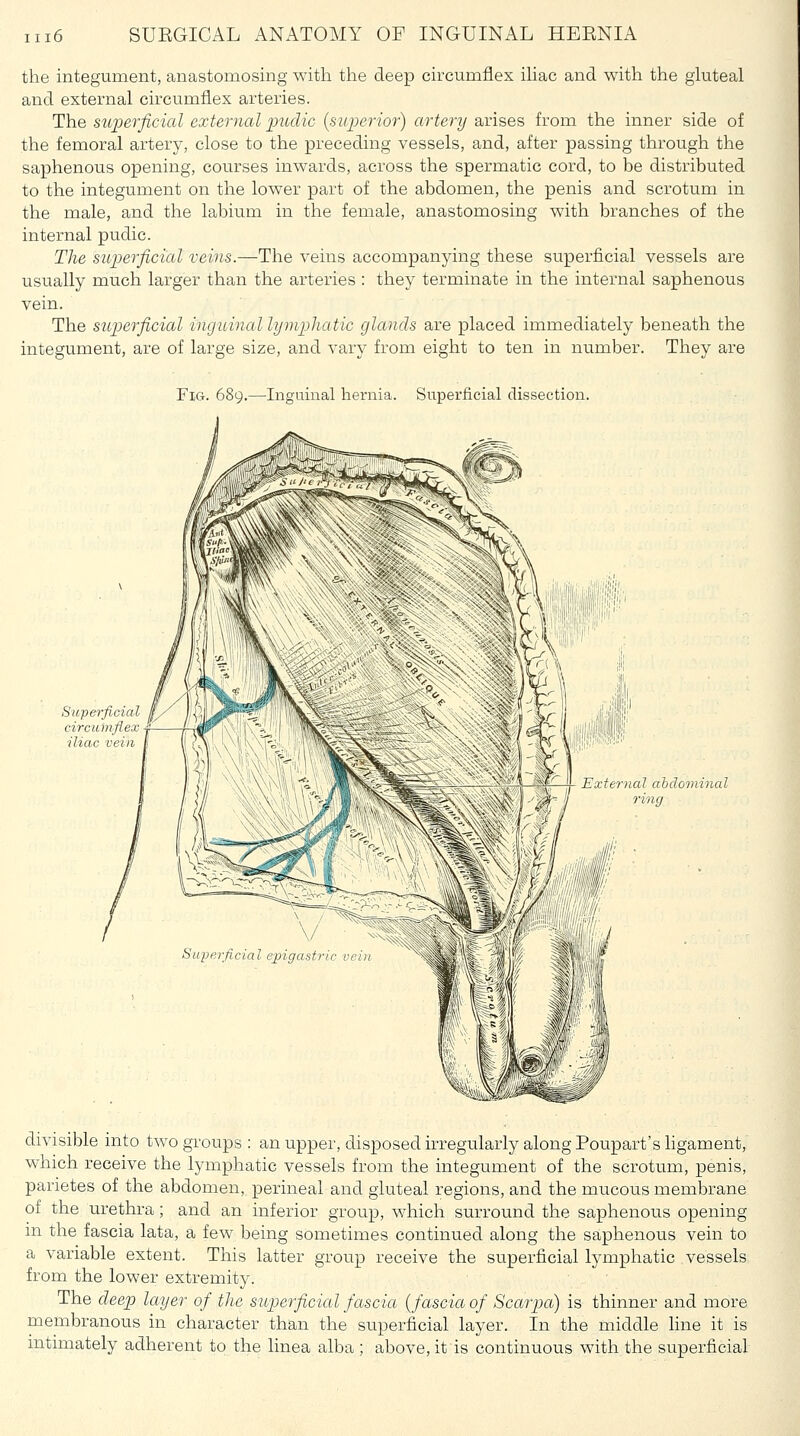 the integument, anastomosing with the deep circumflex ihac and with the gluteal and external circumflex arteries. The sujyerficicd external imclic {superior) artery arises from the inner side of the femoral artery, close to the preceding vessels, and, after passing through the saphenous opening, courses inwards, across the spermatic cord, to be distributed to the integument on the lower part of the abdomen, the penis and scrotum in the male, and the labium in the female, anastomosing with branches of the internal pudic. The superficial veins.—The veins accompanying these superficial vessels are usually much larger than the arteries : they terminate in the internal saphenous vein. The superficial inguinal lymphatic glands are placed immediately beneath the integument, are of large size, and vary from eight to ten in number. They are Fig. 689.—Inguinal hernia. Superficial dissection. Superficial circumflex iliac vein /*i.#*t Exietnal abdominal 9 ing fj' ii'4f 1/ I \/ ^ Supei ficial ejngasttic vein divisible into two groups : an upper, dis^DOsed irregularly along Poupart's ligament, which receive the lymphatic vessels from the integument of the scrotum, penis, parietes of the abdomen, perineal and gluteal regions, and the mucous membrane of the urethra; and an inferior group, which surround the saphenous opening in the fascia lata, a few being sometimes continued along the saphenous vein to a variable extent. This latter group receive the superficial lymphatic vessels from the lower extremity. The deep layer of the superficial fascia {fascia of Scarpa) is thinner and more membranous in character than the superficial layer. In the middle line it is intimately adherent to the linea alba ; above, it is continuous with the superficial