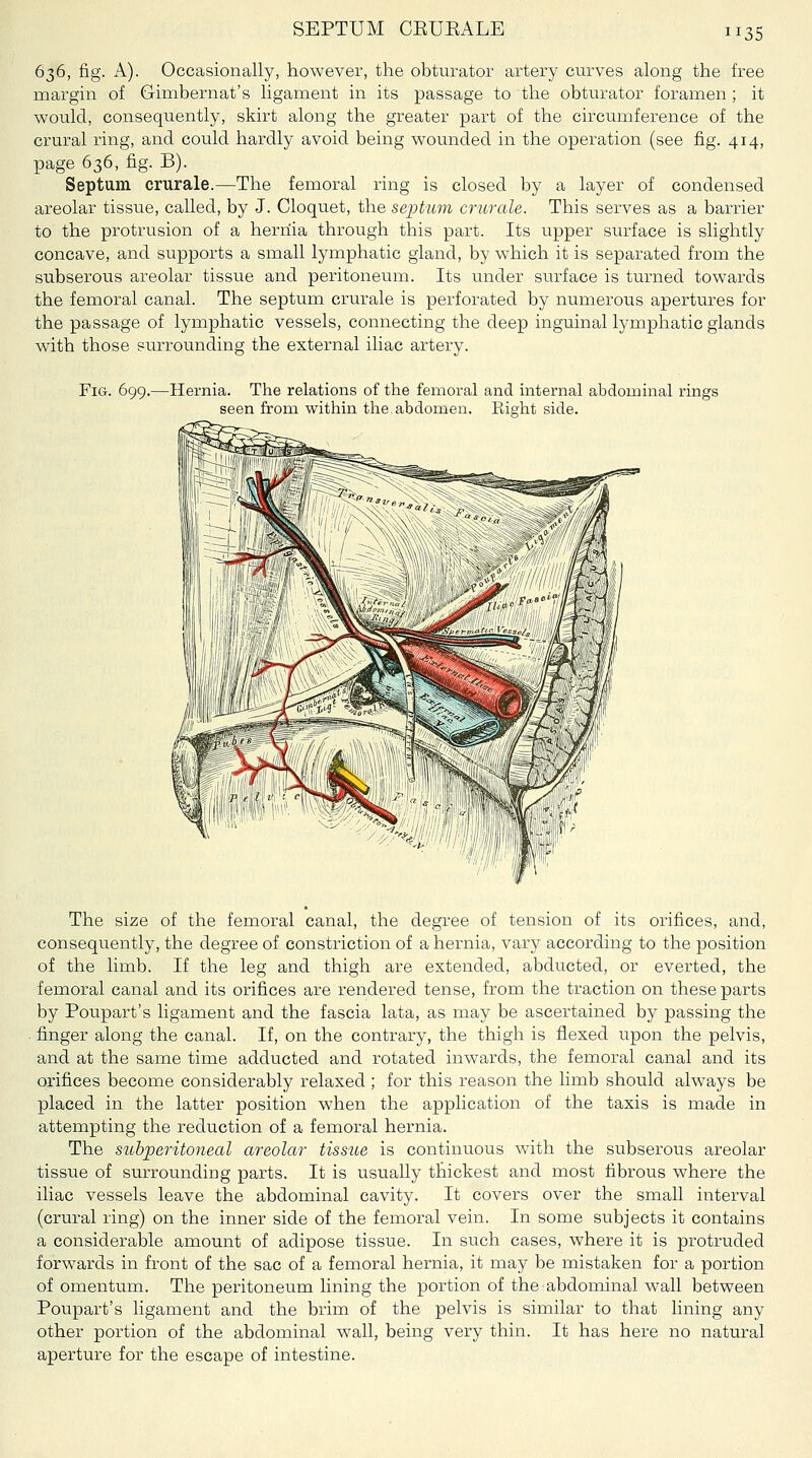 SEPTUM CEUEALE 636, fig. A). Occasionally, however, the obturator artery curves along the free margin of Gimbernat's ligament in its passage to the obturator foramen ; it would, consequently, skirt along the greater part of the circumference of the crural ring, and could hardly avoid being wounded in the operation (see fig. 414, page 636, fig. B). Septum crurale.—The femoral ring is closed by a layer of condensed areolar tissue, called, by J. Cloquet, the septum crurale. This serves as a barrier to the protrusion of a hernia through this part. Its upper surface is slightly concave, and supports a small lymphatic gland, by which it is separated from the subserous areolar tissue and peritoneum. Its under surface is turned towards the femoral canal. The septum crurale is perforated by numerous apertures for the passage of lymphatic vessels, connecting the deep inguinal lymphatic glands with those su.rrounding the external iliac artery. Fig. 699.—Hernia. The relations of the femoral and internal abdominal rings seen from within the.abdomen. Right side. The size of the femoral canal, the degree of tension of its orifices, and, consequently, the degree of constriction of a hernia, vary according to the position of the limb. If the leg and thigh are extended, abducted, or everted, the femoral canal and its orifices are rendered tense, from the traction on these parts by Poupart's ligament and the fascia lata, as may be ascertained by passing the finger along the canal. If, on the contrary, the thigh is flexed upon the pelvis, and at the same time adducted and rotated inwards, the femoral canal and its orifices become considerably relaxed ; for this reason the limb should always be placed in the latter position when the application of the taxis is made in attempting the reduction of a femoral hernia. The stcbperitoneal areolar tissue is continuous with the subserous areolar tissue of surrounding parts. It is usually thickest and most fibrous where the iliac vessels leave the abdominal cavity. It covers over the small interval (crural ring) on the inner side of the femoral vein. In some subjects it contains a considerable amount of adipose tissue. In such cases, where it is protruded forwards in front of the sac of a femoral hernia, it may be mistaken for a portion of omentum. The peritoneum lining the portion of the: abdominal wall between Poupart's ligament and the brim of the pelvis is similar to that lining any other portion of the abdominal wall, being very thin. It has here no natural aperture for the escape of intestine.