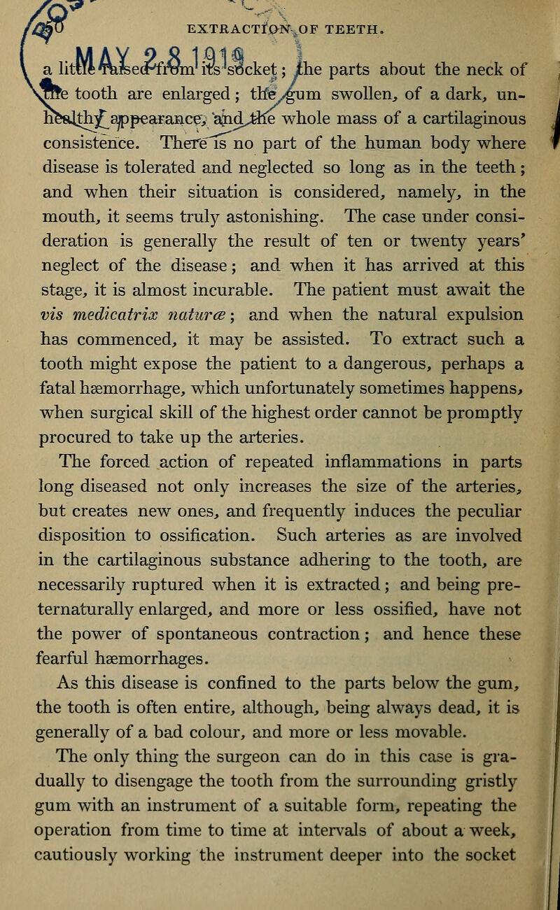 a litcift TOemfram' its 'socket; the parts about the neck of sSte tooth are enlarged; th%/gum swollen, of a dark, un- h&^tirjT appearance, ajid^the whole mass of a cartilaginous consistence. There is no part of the human body where disease is tolerated and neglected so long as in the teeth; and when their situation is considered, namely, in the mouth, it seems truly astonishing. The case under consi- deration is generally the result of ten or twenty years' neglect of the disease; and when it has arrived at this stage, it is almost incurable. The patient must await the vis medicatrix natures; and when the natural expulsion has commenced, it may be assisted. To extract such a tooth might expose the patient to a dangerous, perhaps a fatal haemorrhage, which unfortunately sometimes happens, when surgical skill of the highest order cannot be promptly procured to take up the arteries. The forced action of repeated inflammations in parts long diseased not only increases the size of the arteries, but creates new ones, and frequently induces the peculiar disposition to ossification. Such arteries as are involved in the cartilaginous substance adhering to the tooth, are necessarily ruptured when it is extracted; and being pre- ternaturally enlarged, and more or less ossified, have not the power of spontaneous contraction; and hence these fearful haemorrhages. As this disease is confined to the parts below the gum, the tooth is often entire, although, being always dead, it is generally of a bad colour, and more or less movable. The only thing the surgeon can do in this case is gra- dually to disengage the tooth from the surrounding gristly gum with an instrument of a suitable form, repeating the operation from time to time at intervals of about a week, cautiously working the instrument deeper into the socket