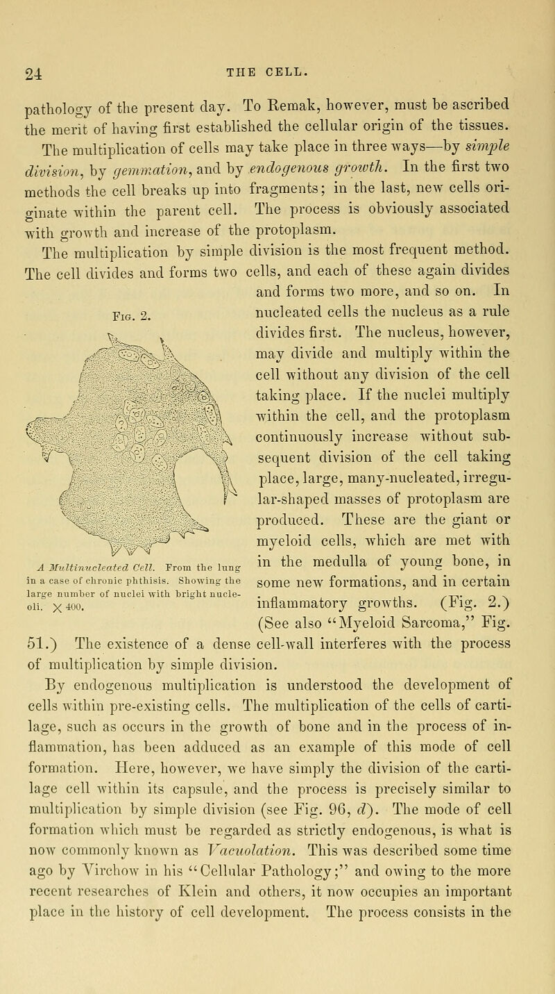 pathology of the present day. To Remak, however, must be ascribed the merit of having first established the cellular origin of the tissues. The multiplication of cells may take place in three ways—by simple division, by gemmation, and by endogenous groivth. In the first two methods the cell breaks up into fragments; in the last, new cells ori- o-inate within the parent cell. The process is obviously associated with growth and increase of the protoplasm. The multiplication by simple division is the most frequent method. The cell divides and forms two cells, and each of these again divides and forms two more, and so on. In Pje_ 2. nucleated cells the nucleus as a rule V. divides first. The nucleus, however, ^^#RfK:^S|!^ % may divide and multiply within the ,|K^ cell without any division of the cell ■ ''::^-'^,^ taking place. If the nuclei multiply ^^- /^ within the cell, and the protoplasm ^. : • il^ continuously increase without sub- 'l'''|i^^S:;i;i:.:?:^^^^ / : ■ ^il sequent division of the cell taking ;' ' / ■ |\ place,large, many-nucleated,irregu- t v K lar-shaped masses of protoplasm are W^ produced. These are the giant or myeloid cells, which are met with A Multinucleated Cell. From the lung ^n the medulla of yOUUg^ bonC, in in a case of chronic phthisis. Showing the gome new formations, and in Certain large number of nuclei with bright nucle- . , ^tt o n oii. X400. inflammatory growths. (rig. A.) (See also Myeloid Sarcoma, Fig. 51.) The existence of a dense cell-wall interferes with the process of multiplication by simple division. By endogenous multiplication is understood the development of cells within pre-existing cells. The multiplication of the cells of carti- lage, such as occurs in the growth of bone and in the process of in- flammation, has been adduced as an example of this mode of cell formation. Here, however, we have simply the division of the carti- lage cell within its capsule, and the process is precisely similar to multiplication by simple division (see Fig. 96, d'). The mode of cell formation which must be regarded as strictly endogenous, is what is now commonly known as Vacuolation. This was described some time ago by Virchow in his Cellular Pathology; and owing to the more recent researches of Klein and others, it now occupies an important place in the history of cell development. The process consists in the