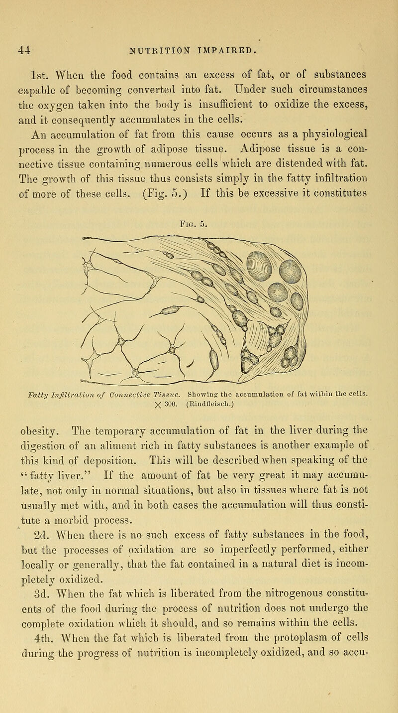 1st. When the food contains an excess of fat, or of substances capable of becoming converted into fat. Under such circumstances the oxygen taken into the body is insufficient to oxidize the excess, and it consequently accumulates in the cells. An accumulation of fat from this cause occurs as a physiological process in the growth of adipose tissue. Adipose tissue is a con- nective tissue containing numerous cells which are distended with fat. The growth of this tissue thus consists simply in the fatty infiltration of more of these cells. (Fig. 5.) If this be excessive it constitutes Fig. 5. Fatty Infiltration of Connective Tissue. Showing the accumulation of fat within the ceUs. X 300. (Eindfieisch.) obesity. The temporary accumulation of fat in the liver during the digestion of an aliment rich in fatty substances is another example of this kind of deposition. This will be described when speaking of the fatty liver. If the amount of fat be very great it may accumu- late, not only in normal situations, but also in tissues where fat is not usually met with, and in both cases the accumulation will thus consti- tute a morbid process. 2d. When there is no such excess of fatty substances in the food, but the processes of oxidation are so imperfectly performed, either locally or generally, that the fat contained in a natural diet is incom- pletely oxidized. 3d. When the fat which is liberated from the nitrogenous constitu- ents of the food during the process of nutrition does not undergo the complete oxidation Avhich it should, and so remains within the cells. 4th. When the fat which is liberated from the protoplasm of cells during the progress of nutrition is incompletely oxidized, and so accu-