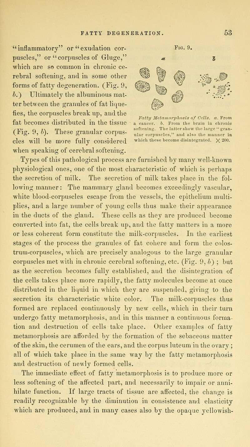 inflammatory or exudation cor- Fig. 9. puscles, or  corpuscles of Gluge, « 3 which are so common in chronic ce- rebral softening, and in some other ^3 W |||| v:.^k ,.^.Jl forms of fatty degeneration. (Fig. 9, ^^^ ^^^^ *'^'' -^^f} h.') Ultimately the albuminous mat- ter between the granules of fat lique- fies, the corpuscles break up, and the . . , . Fatty Metamorplwsis of Cells, a. From fat becomes distributed m the tissue a cancer. 6. From the brain ia chronic /■t:\- f\ 7\ mi 1 softenin£r. The latter show the large ^ran- (Fig. 9, h). These granular corpus- ^j,, corpuscles, and also the manner in Cles will be more fully considered which these become disintegrated. X200. when speaking of cerebral softening. Types of this pathological process are furnished by many well-known physiological ones, one of the most characteristic of which is perhaps the secretion of milk. The secretion of milk takes place in the fol- lowing manner: The mammary gland becomes exceedingly vascular, white blood-corpuscles escape from the vessels, the epithelium multi- plies, and a large number of young cells thus make their appearance in the ducts of the gland. These cells as they are produced become converted into fat, the cells break up, and the fatty matters in a more or less coherent form constitute the milk-corpuscles. In the earliest stages of the process the granules of fat cohere and form the colos- trum-corpuscles, which are precisely analogous to the large granular corpuscles met with in chronic cerebral softening, etc. (Fig. 9, &} ; but as the secretion becomes fully established, and the disintegration of the cells takes place more rapidly, the fatty molecules become at once distributed in the liquid in which they are suspended, giving to the secretion its characteristic white color. The milk-corpuscles thus formed are replaced continuously by new cells, which in their turn undergo fatty metamorphosis, and in this manner a continuous forma- tion and destruction of cells take place. Other examples of fatty metamorphosis are afforded by the formation of the sebaceous matter of the skin, the cerumen of the ears, and the corpus luteum in the ovary ; all of which take place in the same way by the fatty metamorphosis and destruction of newly formed cells. The immediate effect of fatty metamorphosis is to produce more or less softening of the affected part, and necessarily to impair or anni- hilate function. If large tracts of tissue are affected, the change is readily recognizable by the diminution in consistence and elasticity which are produced, and in many cases also by the opaque yellowish-