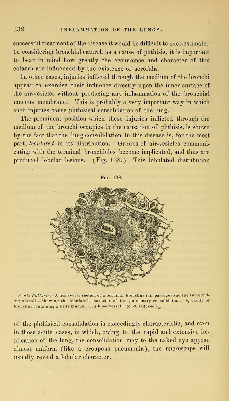 successful treatment of the disease it would be difficult to over-estimate. In considering bronchial catarrh as a cause of phthisis, it is important to bear in mind how greatly the occurrence and character of this catarrh are influenced by the existence of scrofula. In other cases, injuries inflicted through the medium of the bronchi appear to exercise their influence directly upon the inner surface of the air-vesicles without producing any inflammation of the bronchial mucous membrane. This is probably a very important way in which such injuries cause phthisical consolidation of the lung. The prominent position which these injuries inflicted through the medium of the bronchi occupies in the causation of phthisis, is shown by the fact that the lung-consolidation in this disease is, for the most part, lohulated in its distribution. Groups of air-vesicles communi- cating with the terminal bronchioles become implicated, and thus are produced lobular lesions. (Fig. 138.) This lobulated distribution Fig. 138. Acute Phthisis.—A transverse section of a terminal bronchus (air-passage) and the surround- ing alveoli.—Showing the lobulated character of the pulmonary consolidation. 6, cavity of bronchus containing a little mucus, v, a bloodvessel. X jOj reduced J^. of the phthisical consolidation is exceedingly characteristic, and even in those acute cases, in which, owing to the rapid and extensive im- plication of the lung, the consolidation may to the naked eye appear almost uniform (like a croupous pneumonia), the microscope will usually reveal a lobular character.