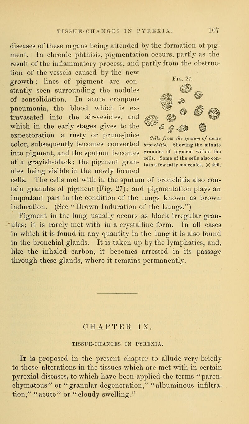 diseases of these organs being attended by the formation of pig- ment. In chronic phthisis, pigmentation occurs, partly as the result of the inflammatory process, and partly from the obstruc- tion of the vessels caused by the new growth; lines of pigment are con- ^^^- ^^• stantly seen surrounding the nodules of consolidation. In acute croupous pneumonia, the blood which is ex- travasated into the air-vesicles, and which in the early stages gives to the expectoration a rusty or prune-juice odis from the sputum of acute color, subsequently becomes converted broneMtis. showing the minute into pigment, and the sputum becomes granules of pigment within the „ • 1 1 1 1 ,1 • i cells. Some of the cells also con- of a grayish-black; the pigment gran- tain a few fatty molecules. x40o. ules being visible in the newly formed cells. The cells met with in the sputum of bronchitis also con- tain granules of pigment (Fig. 27); and pigmentation plays an important part in the condition of the lungs known as brown induration. (See Brown Induration of the Lungs.) Pigment in the lung usually occurs as black irregular gran- ^ules; it is rarely met with in a crystalline form. In all cases in which it is found in any quantity in the lung it is also found in the bronchial glands. It is taken up by the lymphatics, and, like the inhaled carbon, it becomes arrested in its passage through these glands, where it remains permanently. CHAPTER IX. TISSUE-CHANGES IN PYREXIA. It is proposed in the present chapter to allude very briefly to those alterations in the tissues which are met with in certain pyrexial diseases, to which have been applied the terms paren- chymatous or granular degeneration, albuminous infiltra- tion, acute or cloudy swelling.