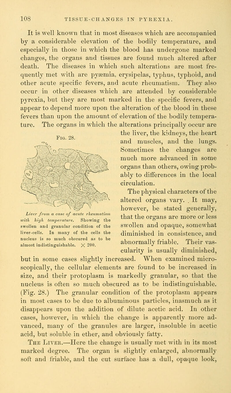 It is well known that in most diseases which are accompanied by a considerable elevation of the bodily temperature, and especially in those in which the blood has undergone marked changes, the organs and tissues are found much altered after death. The diseases in which such alterations are most fre- quently met with are pyaemia, erysipelas, typhus, typhoid, and other acute specific fevers, and acute rheumatism. They also occur in other diseases which are attended by considerable pyrexia, but they are most marked in the specific fevers, and appear to depend more upon the alteration of the blood in these fevers than upon the amount of elevation of the bodily tempera- ture. The organs in which the alterations principally occur are the liver, the kidneys, the heart ^^ ■ ■ and muscles, and the lungs. ^' Sometimes the changes are :; much more advanced in some organs than others, owing prob- v^ ' ably to differences in the local , circulation. -^-^ ^^^.-v The physical characters of the _ altered organs vary. . It may, however, be stated generally, Liici fiom a case of acute rheumatism j.i j. j.i i .,,/,, / „, . ,, that the organs are more or less loith high temperature. Snowing the ts swollen and granular condition of the SWOllcU and OpaqUC, SOmewhat liver-cells. In many of the cells the diminished in consisteucc, and nucleus is so much obscured as to be , ^^ n • ^ ^ mi almost indistinguishable. X 200. abnormally friable. Their vas- cularity is usually diminished, but in some cases slightly increased. When examined micro- scopically, the cellular elements are found to be increased in size, and their protoplasm is markedly granular, so that the nucleus is often so much obscured as to be indistinguishable. (Fig. 28.) The granular condition of the protoplasm appears in most cases to be due to albuminous particles, inasmuch as it disappears upon the addition of dilute acetic acid. In other cases, however, in which the change is apparently more ad- vanced, many of the granules are larger, insoluble in acetic acid, but soluble in ether, and obviously fatty. The Liver.—Here the change is usually met with in its most marked degree. The organ is slightly enlarged, abnormally soft and friable, and the cut surface has a dull, opaque look,